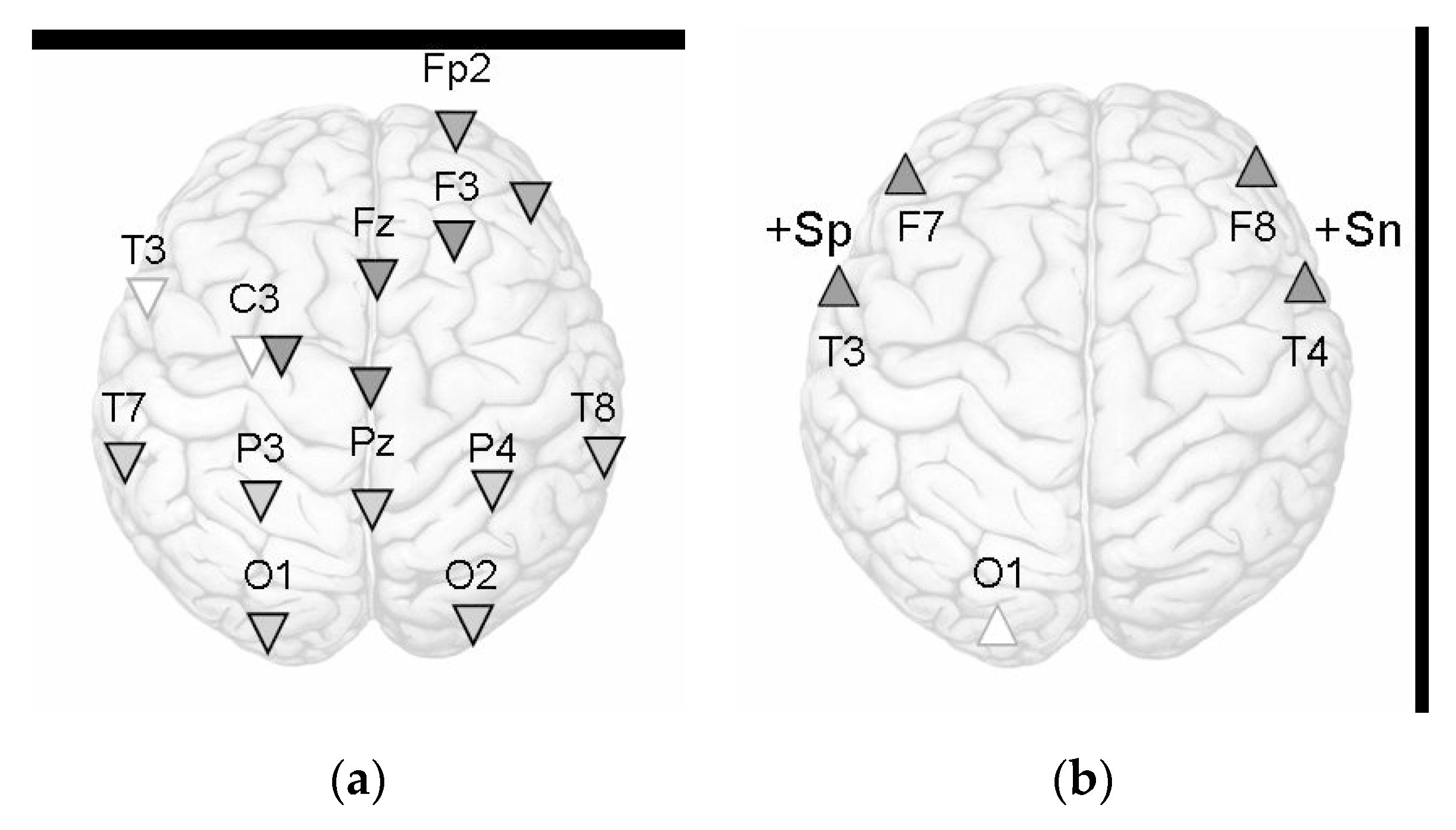Behavioral Sciences | Free Full-Text | Imbalance between Emotionally  Negative and Positive Life Events Retrieval and the Associated Asymmetry of  Brain Activity