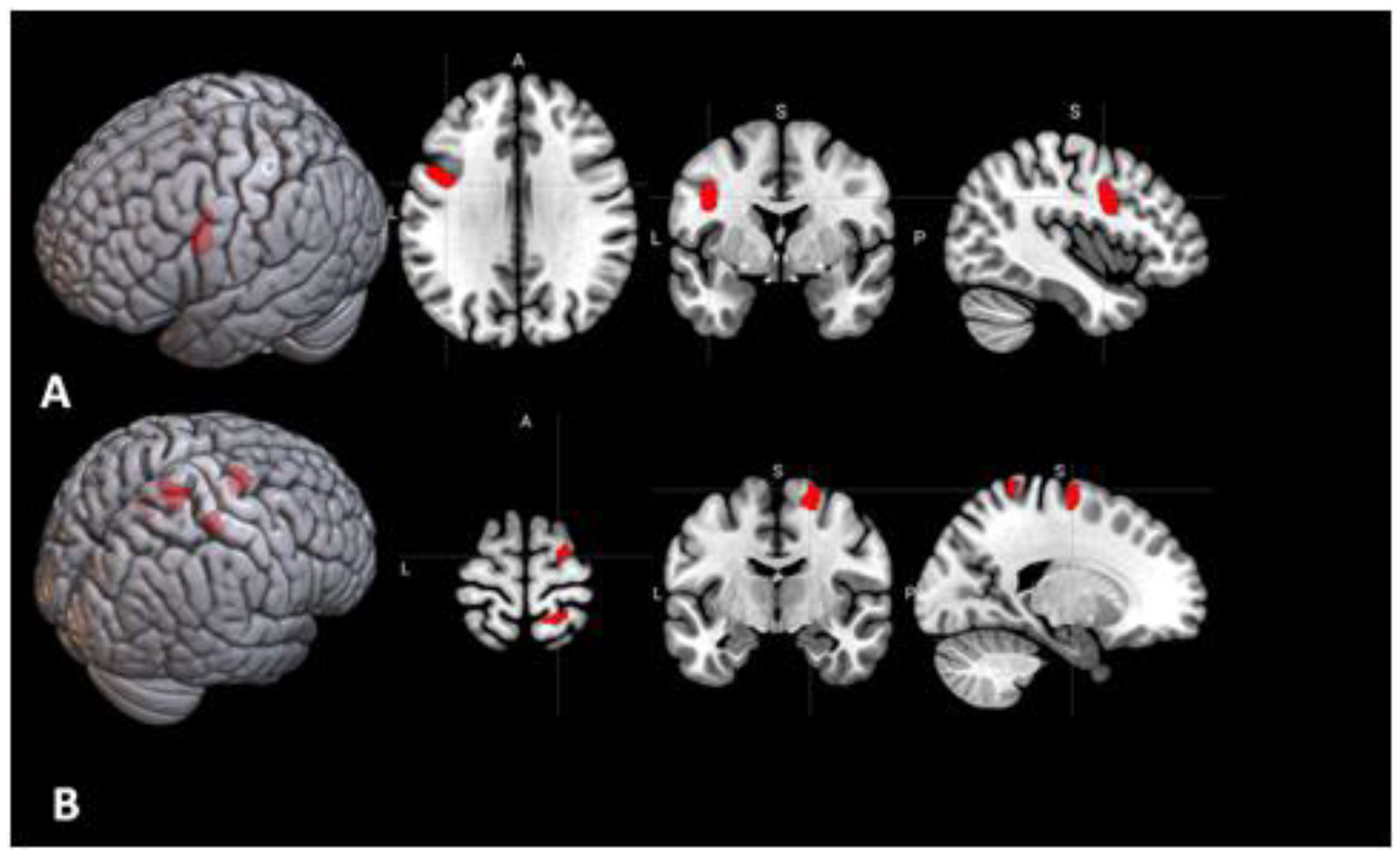 Behavioral Sciences Free Full Text Brain Activations And Functional Connectivity Patterns Associated With Insight Based And Analytical Anagram Solving Html