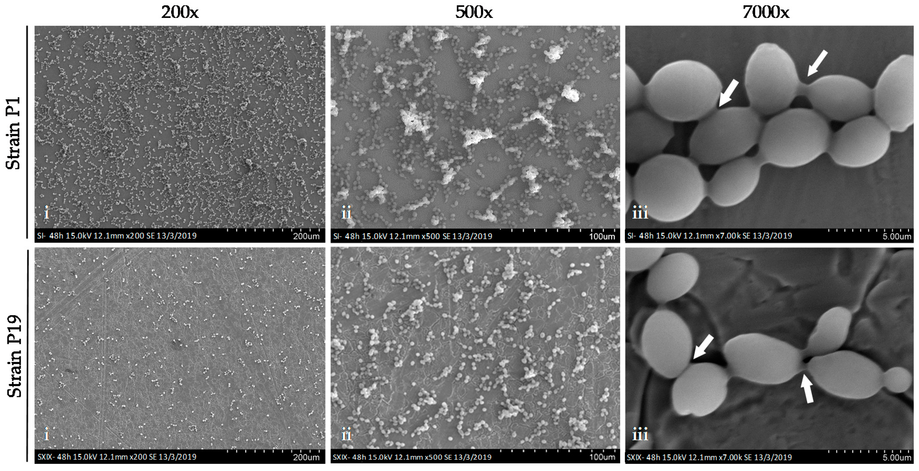 Saccharomyces cerevisiae метиленовый синий. Saccharomyces cerevisiae культивирование. Антитела к Saccharomyces cerevisiae. Saccharomyces cerevisiae производство биотоплива.