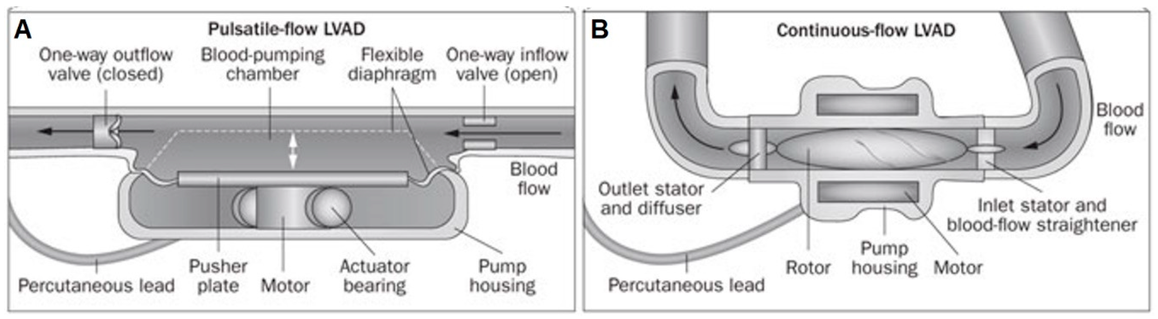 Bioengineering | Free Full-Text | Cardiac Assist Devices: Early Concepts,  Current Technologies, and Future Innovations | HTML