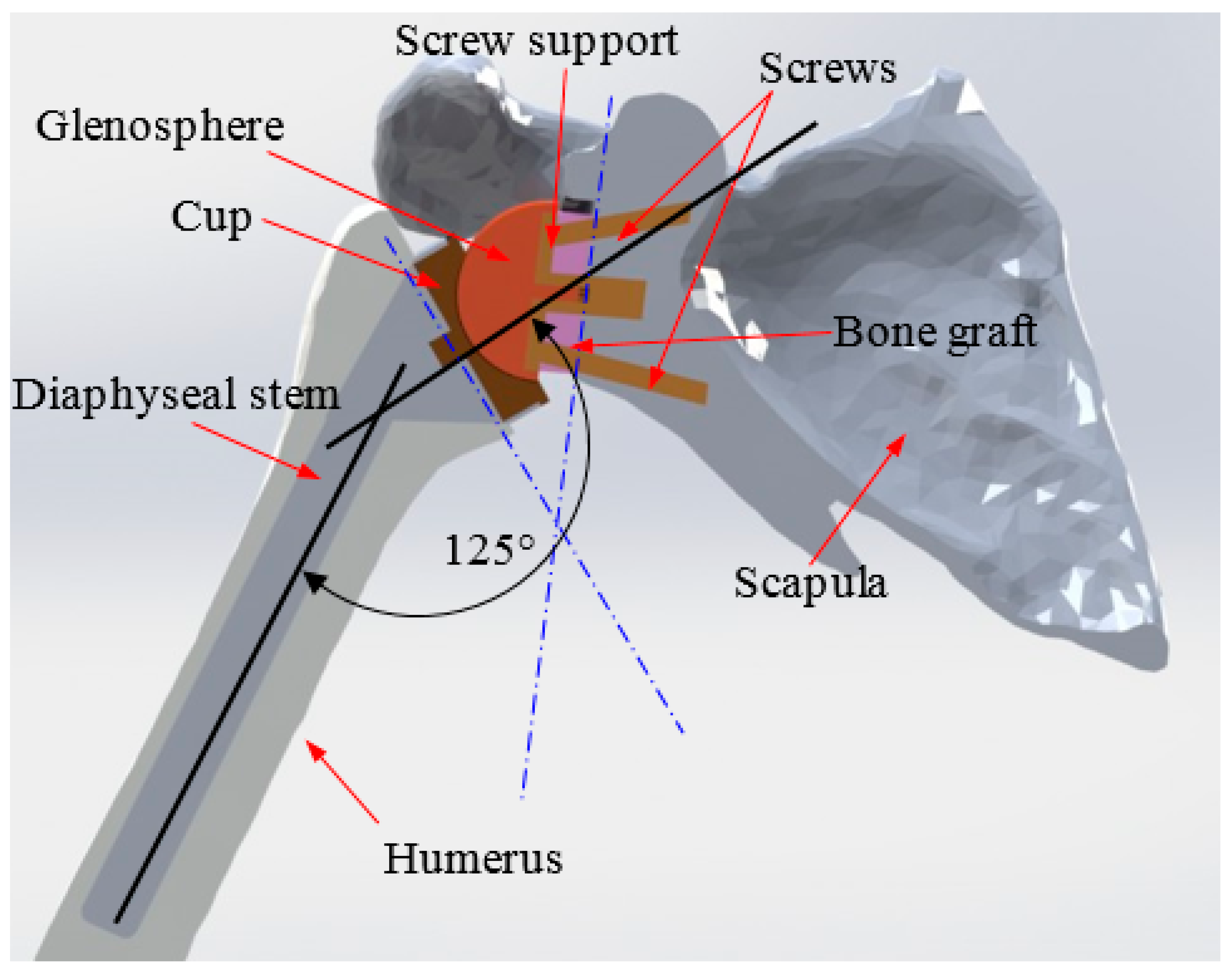 Bioengineering 06 00019 g003