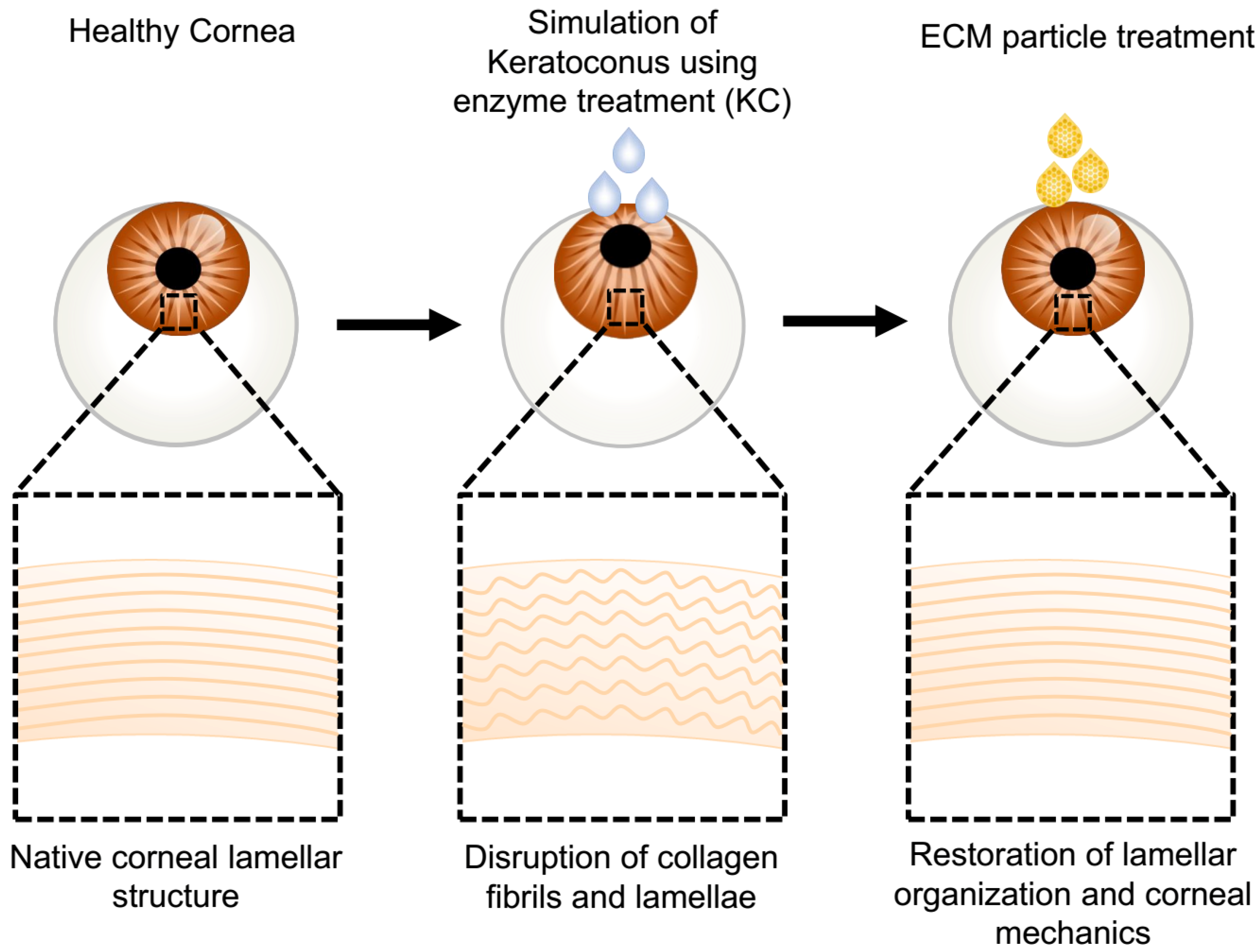 In vivo corneal elastography: A topical review of challenges and  opportunities - Computational and Structural Biotechnology Journal