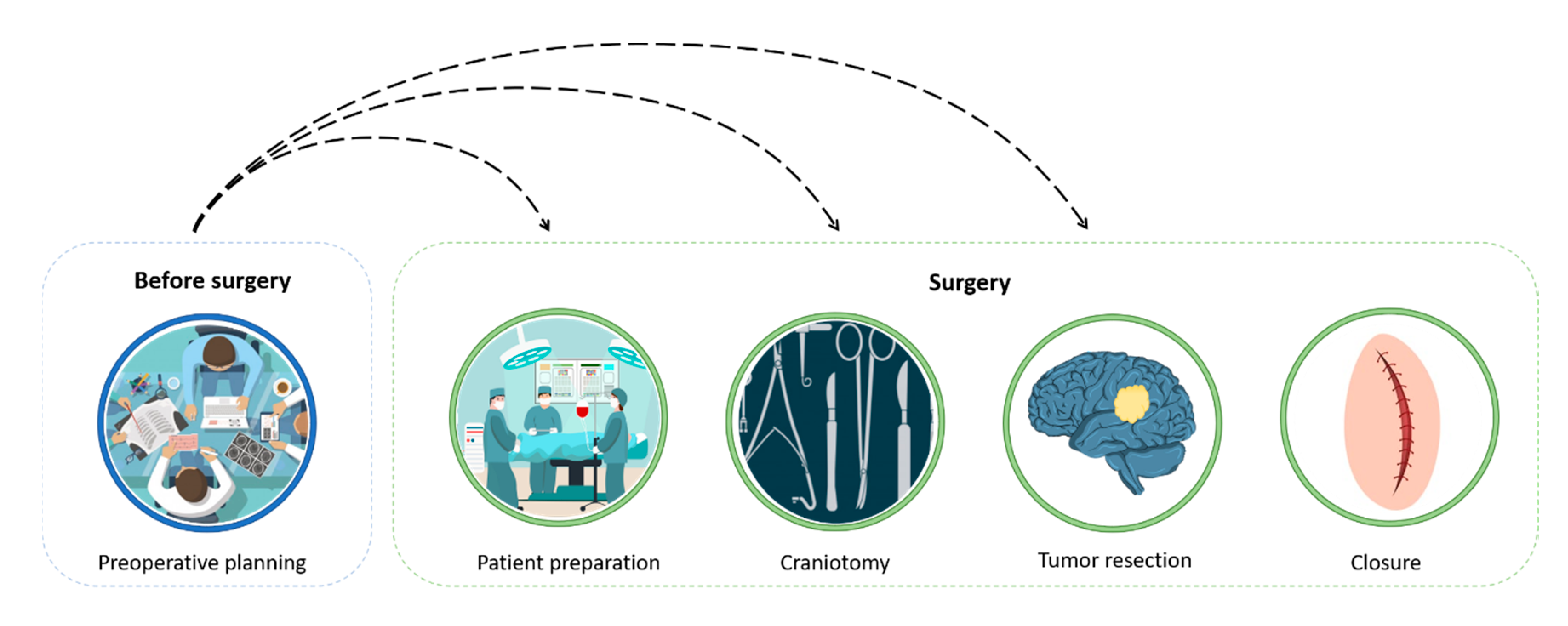 Bioengineering | Free Full-Text | Current Practice in Preoperative Virtual  and Physical Simulation in Neurosurgery
