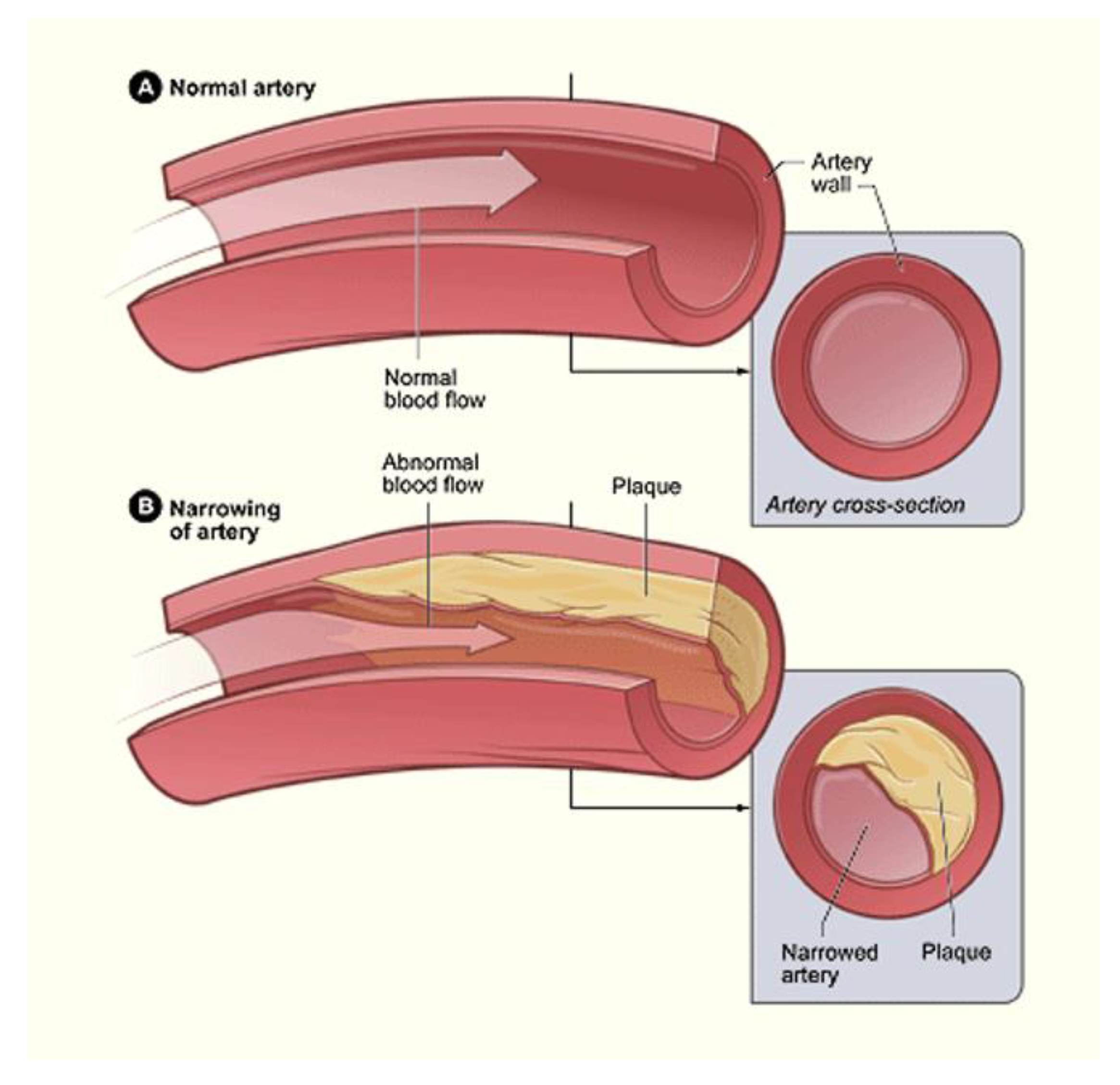 Bioengineering 07 00088 g008 Bioengineering 07 00088 g008
