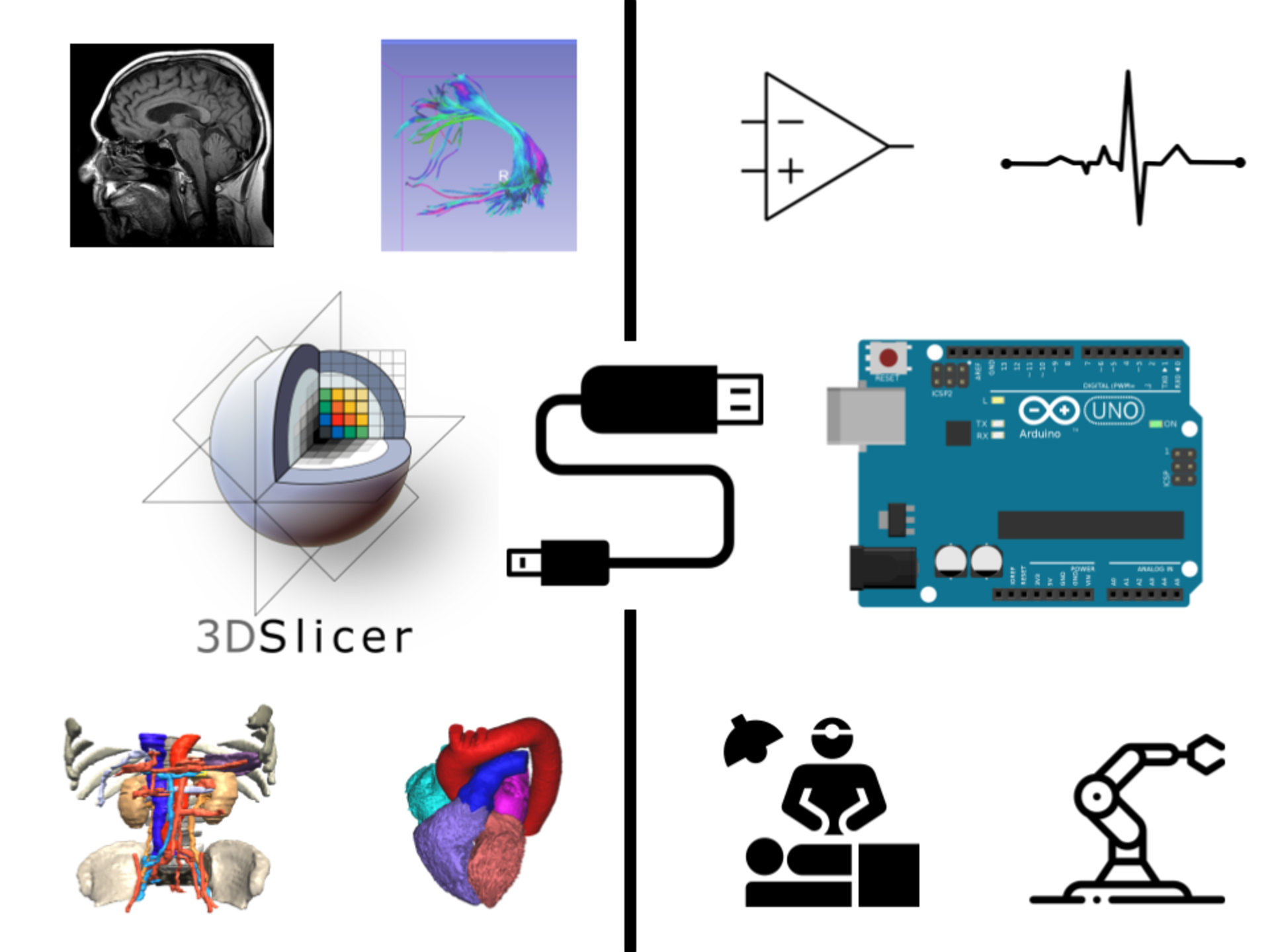 SlicerArduino graphical abstract