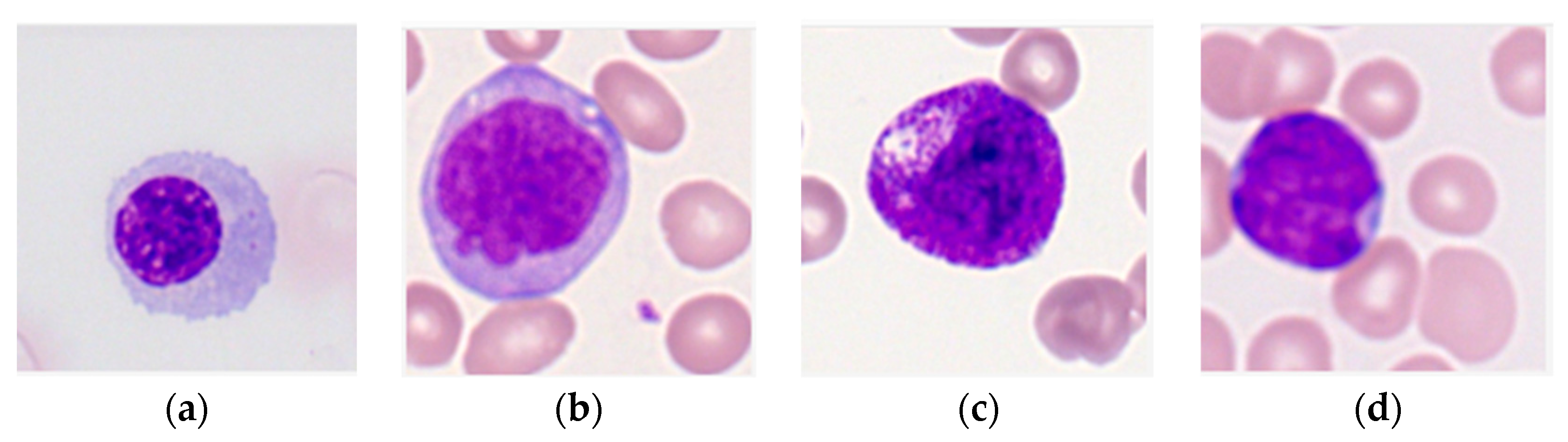 Bioengineering | Free Full-Text | Detection and Classification of Immature  Leukocytes for Diagnosis of Acute Myeloid Leukemia Using Random Forest  Algorithm | HTML