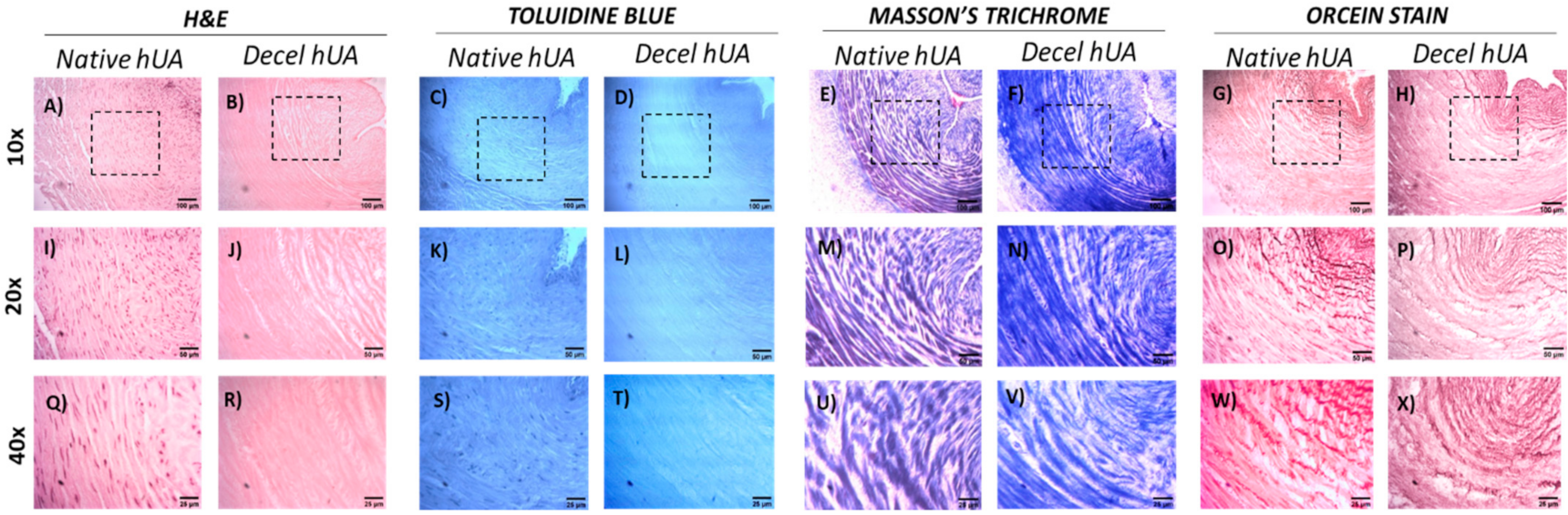 Bioengineering Free Full Text Improved Repopulation Efficacy Of Decellularized Small Diameter Vascular Grafts Utilizing The Cord Blood Platelet Lysate Html