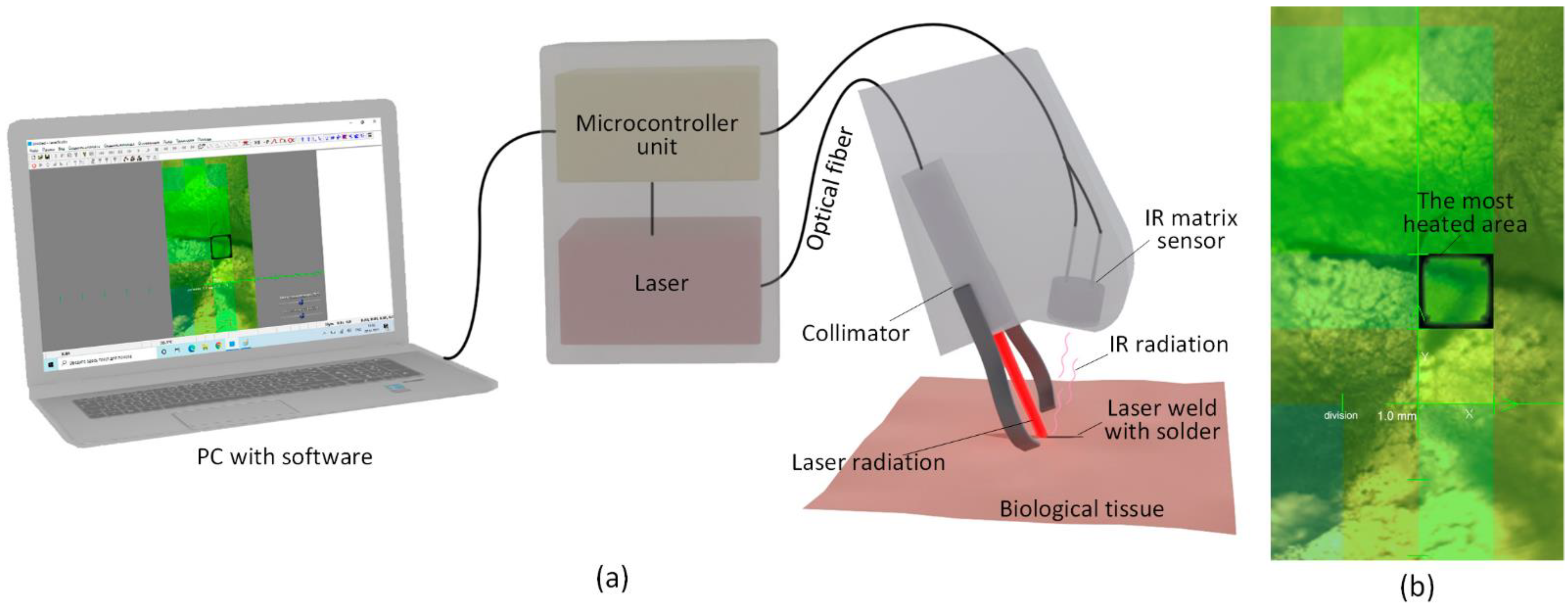 Bioengineering | Free Full-Text | Reconstruction of Soft Biological Tissues  Using Laser Soldering Technology with Temperature Control and Biopolymer  Nanocomposites
