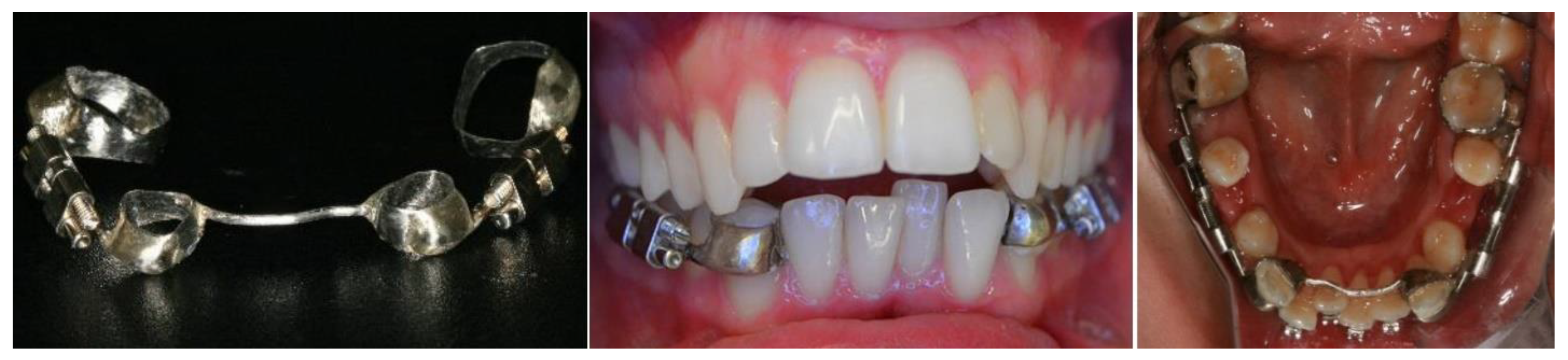 Bioengineering 09 00371 g003 Bioengineering 09 00371 g003