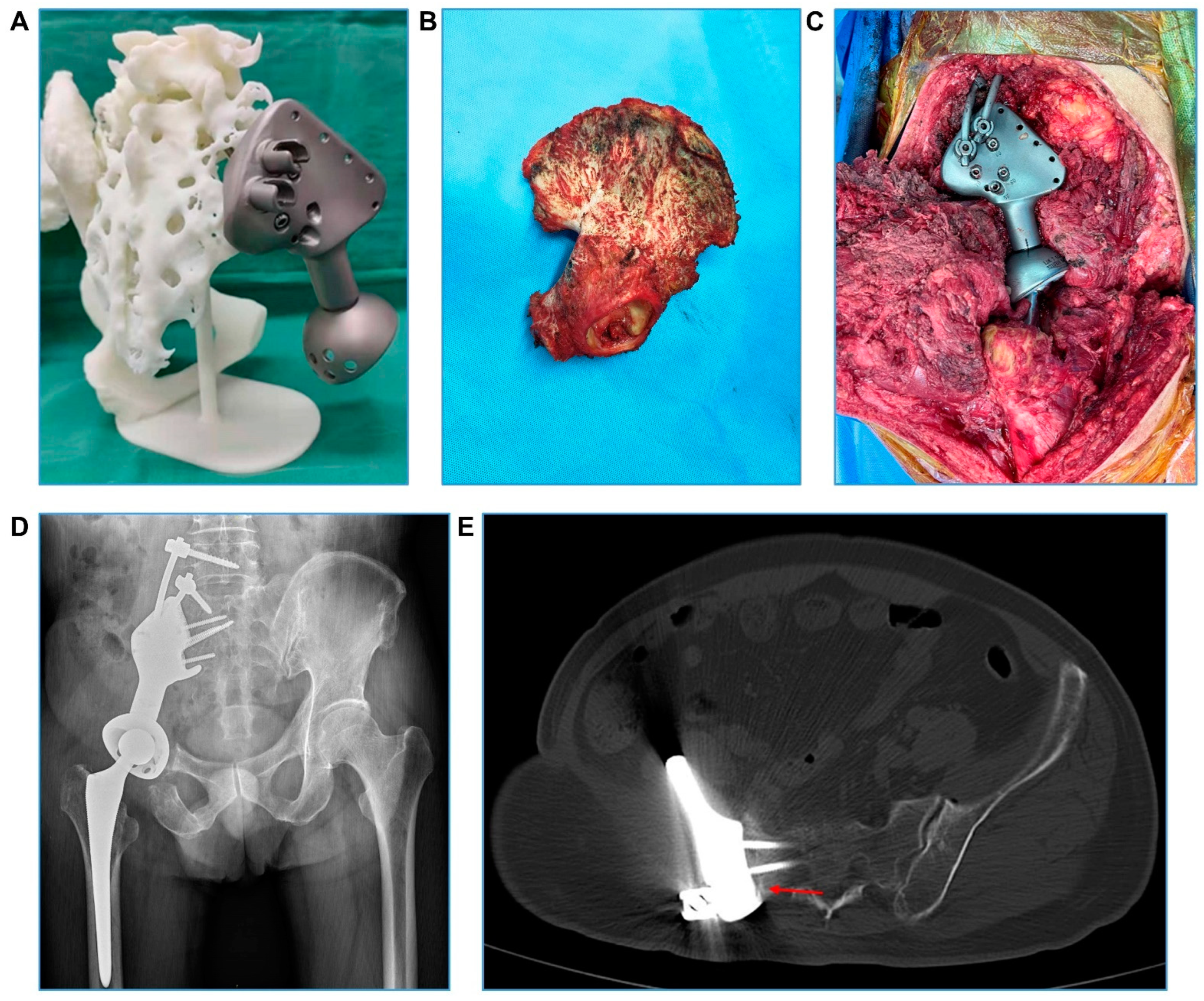 Bioengineering 09 00400 g002 Bioengineering 09 00400 g002
