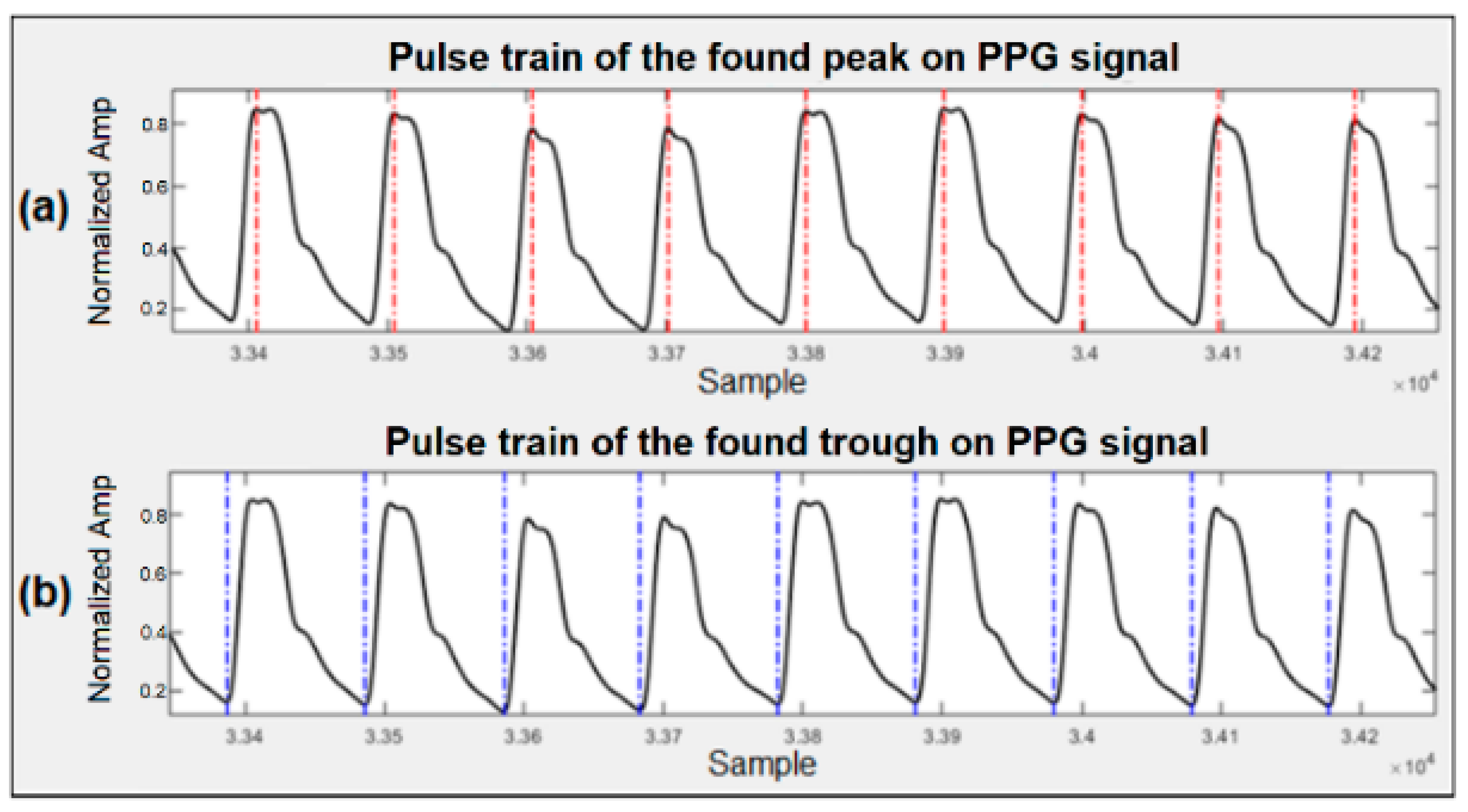 Cuffless Blood Pressure Monitors: Principles, Standards and Approval for  Medical Use