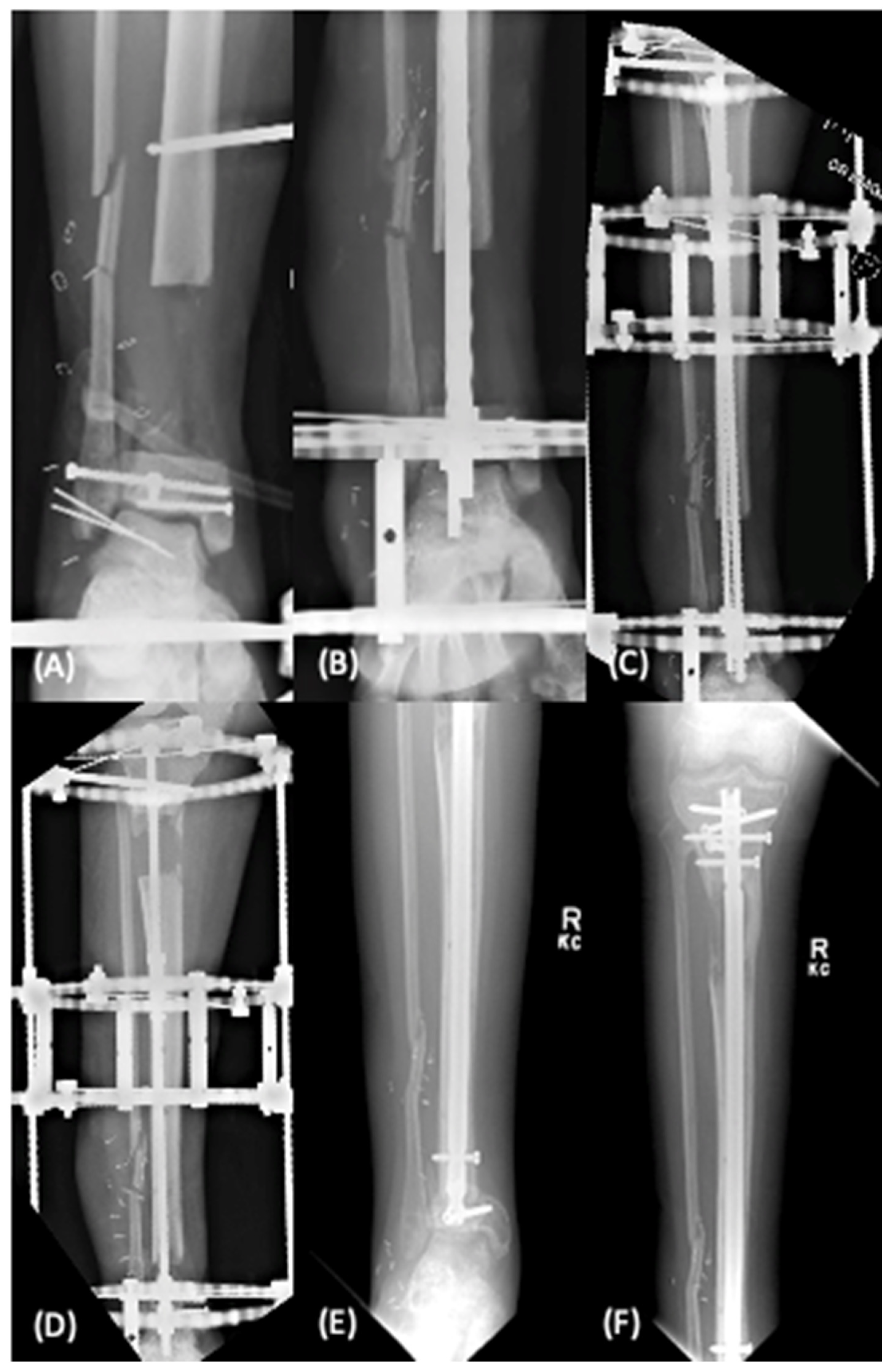 Bioengineering 09 00680 g002