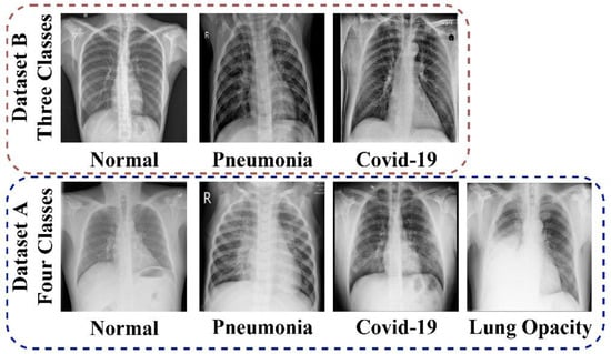 Bioengineering | Free Full-Text | Automated Lung-Related Pneumonia and ...
