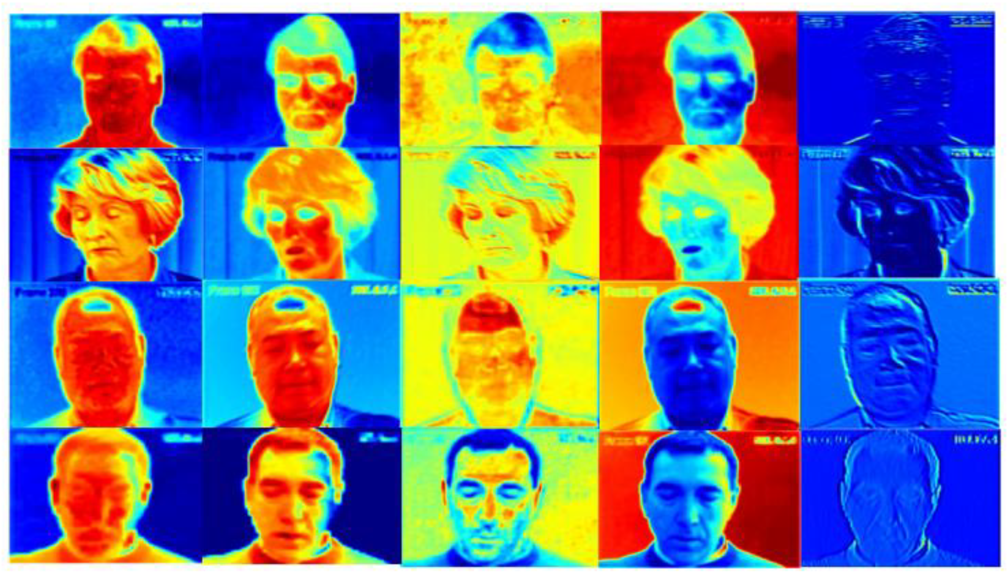 Bioengineering 09 00804 g004 Bioengineering 09 00804 g004