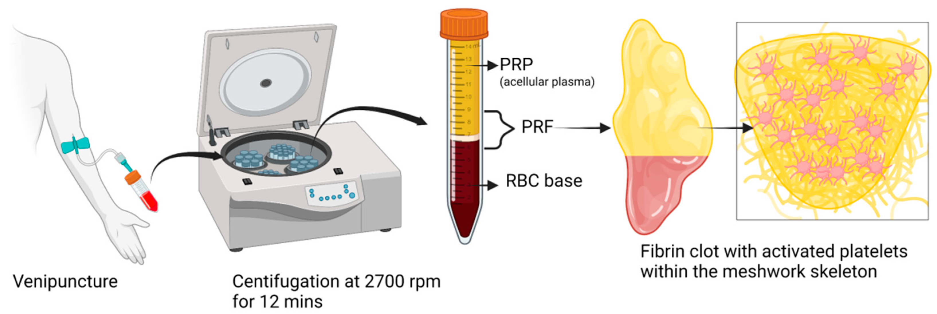 Bioengineering Free Full Text Evolution And Clinical Advances Of