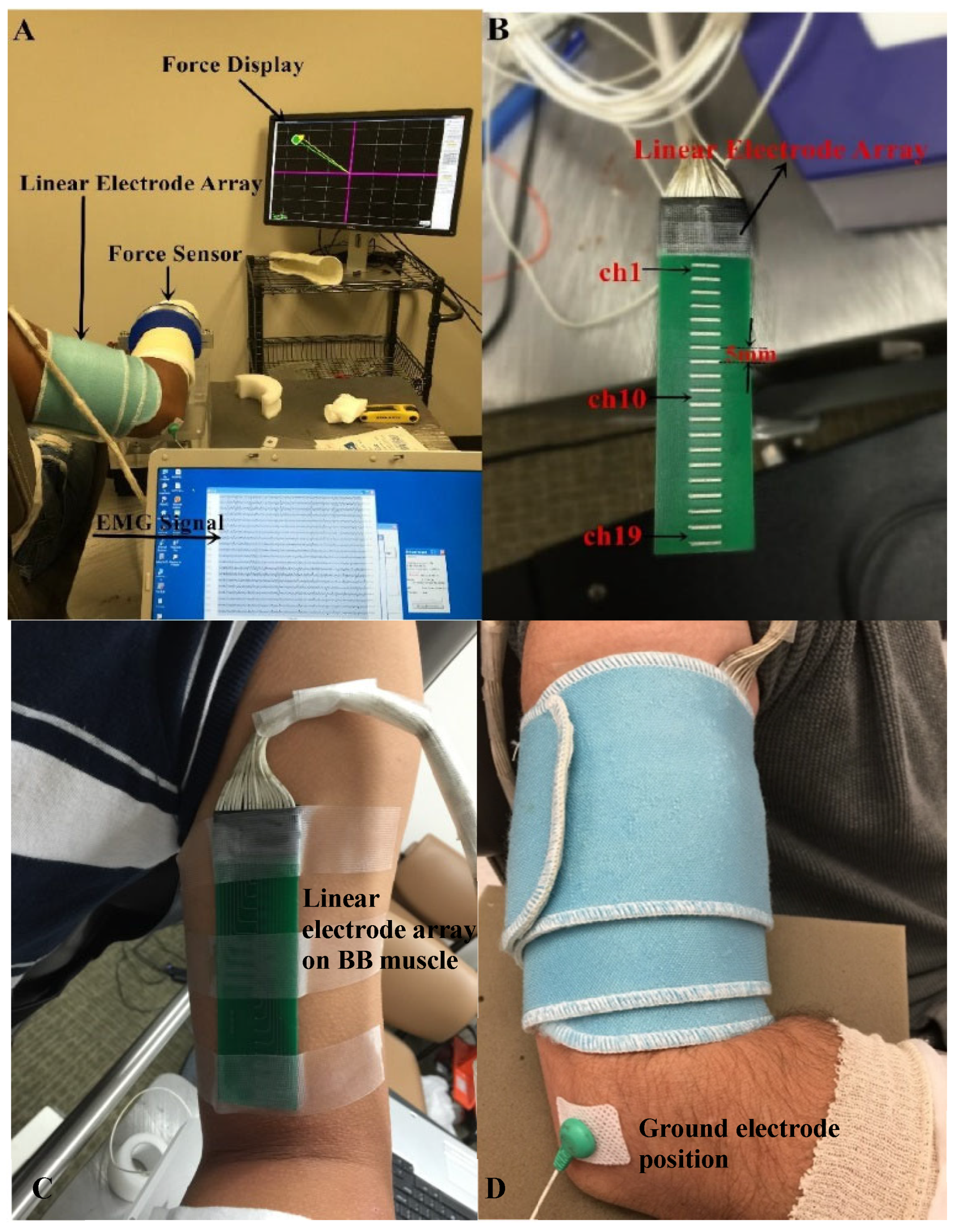 Surface electrodes positioned to apply neuromuscular electrical