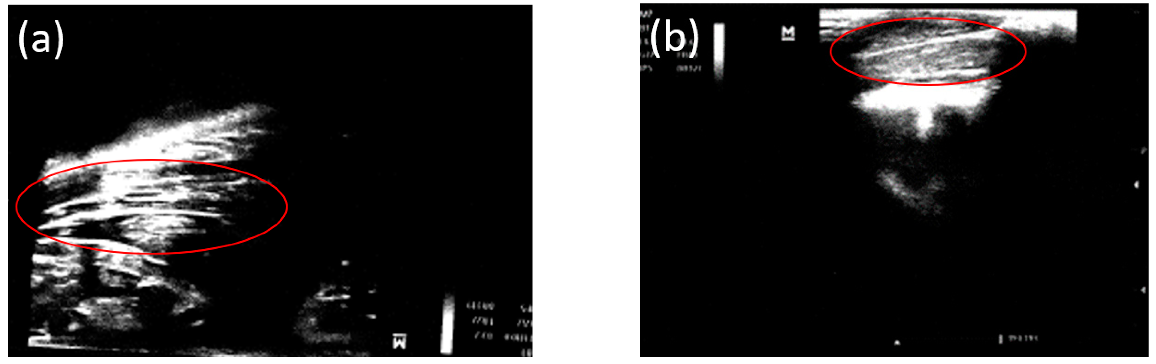 Bioengineering 10 00273 g006 Bioengineering 10 00273 g006