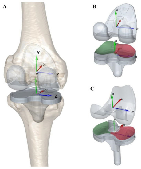 Solved] The contact between femoral and tibia components in knee joint