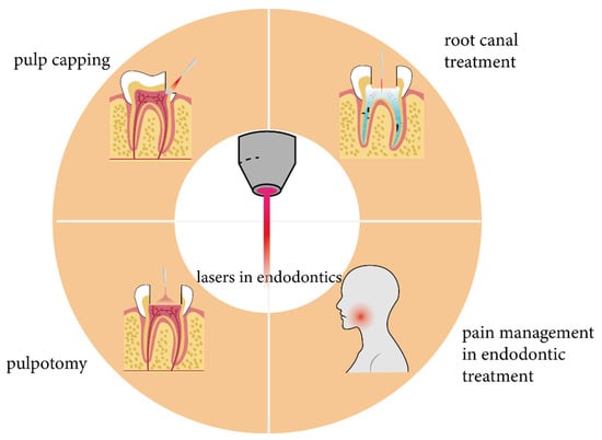 Literature Offers Little Direction on the Safety and Efficacy of Low-level  Laser Therapy for Back Pain