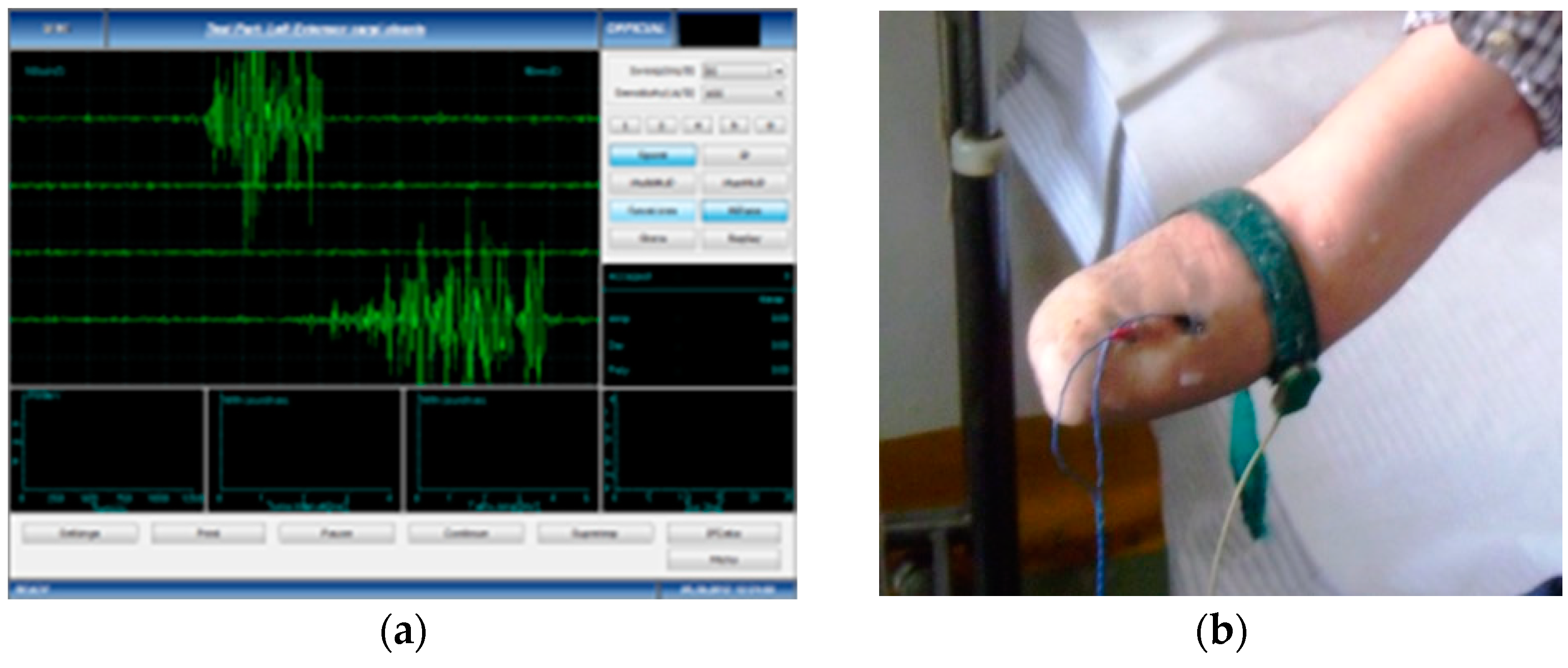 Bioengineering 10 00319 g001 Bioengineering 10 00319 g001