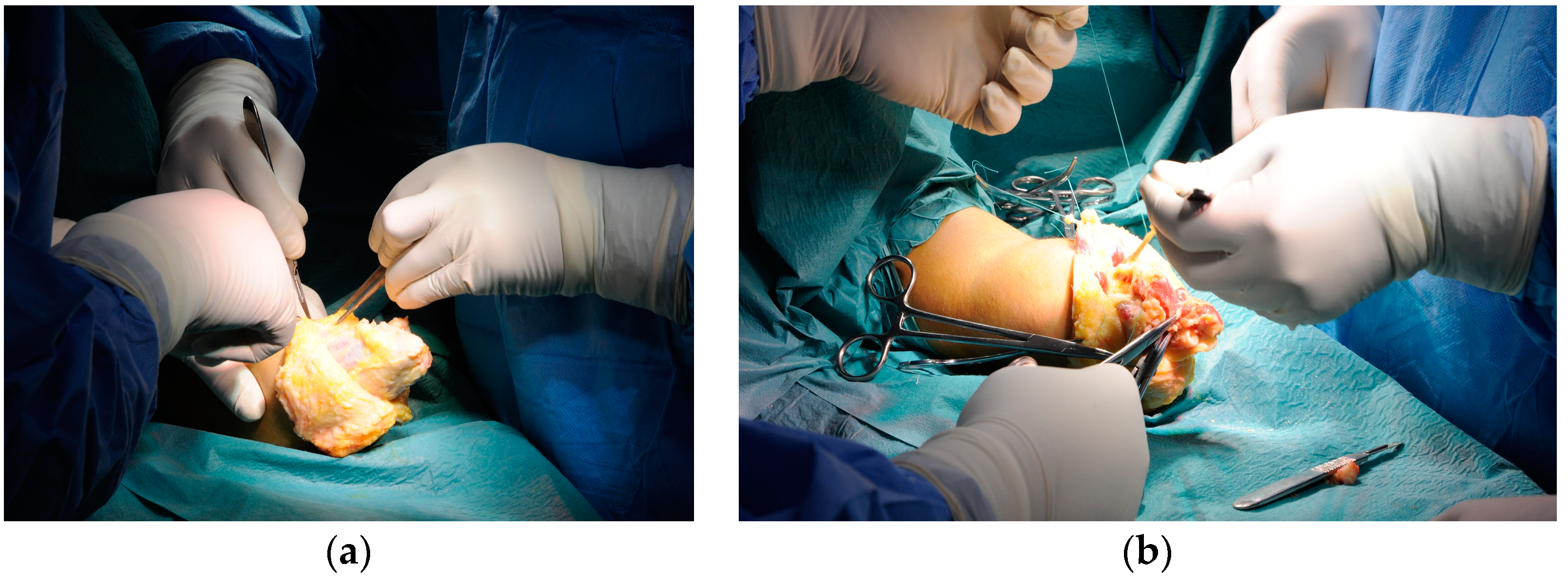 Bioengineering 10 00319 g006 Bioengineering 10 00319 g006