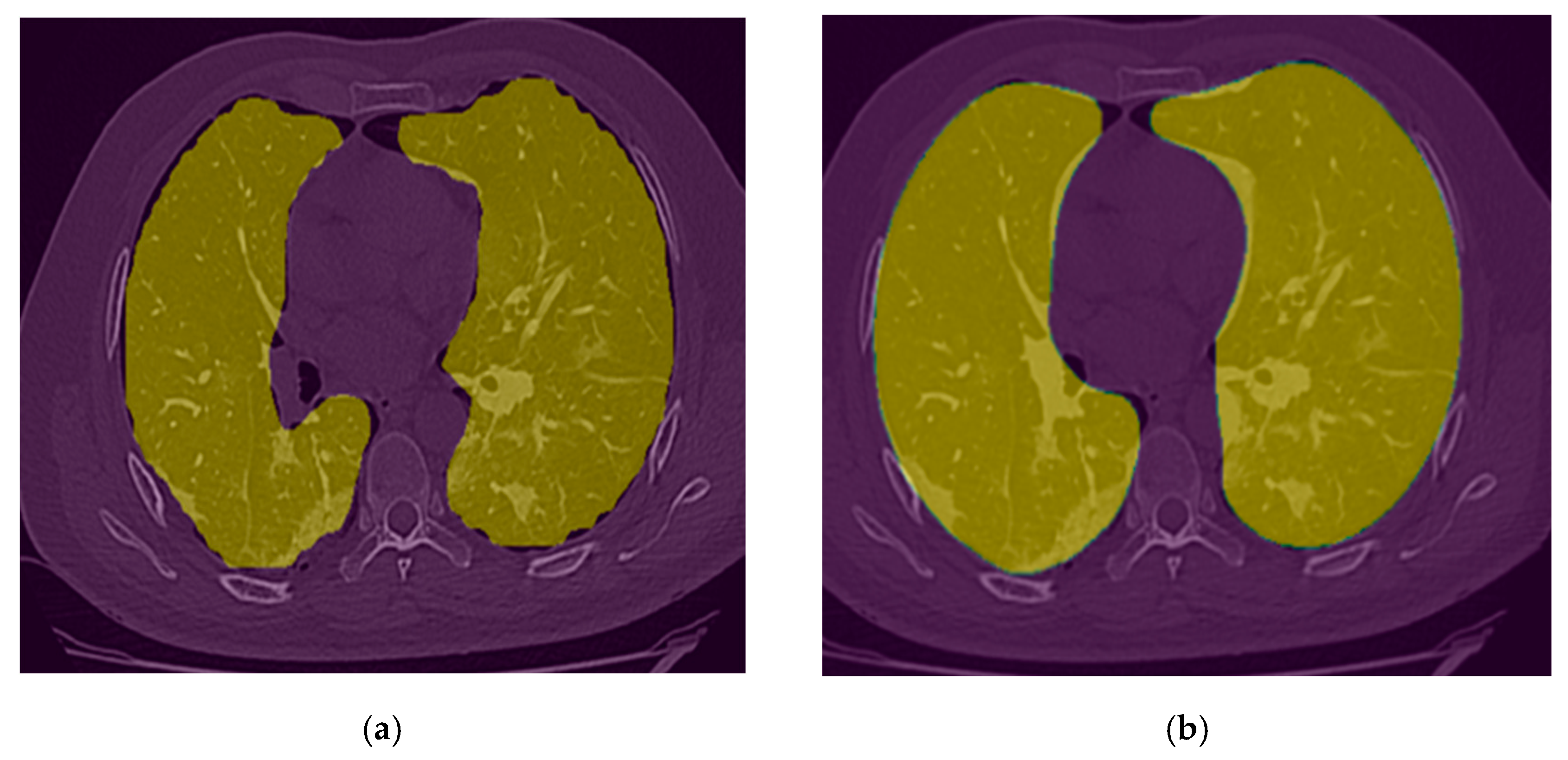 Bioengineering 10 00321 g006