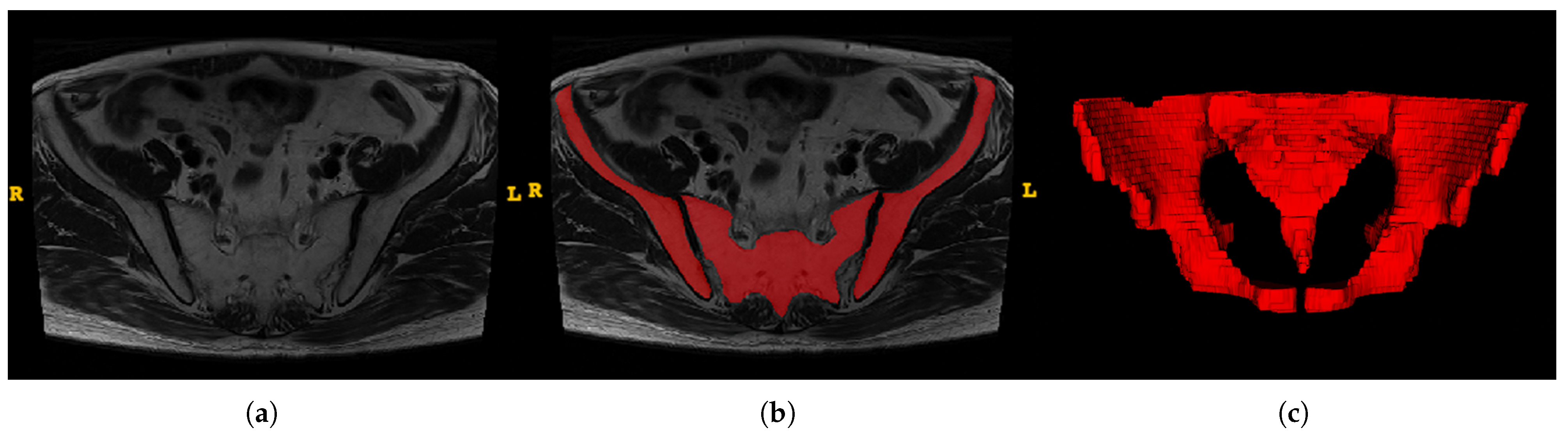 Bioengineering 10 00468 g003 Bioengineering 10 00468 g003