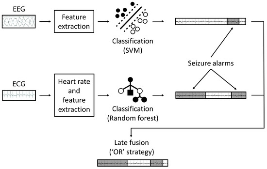 Abrazo Health using AI-powered EEG system for seizure detection