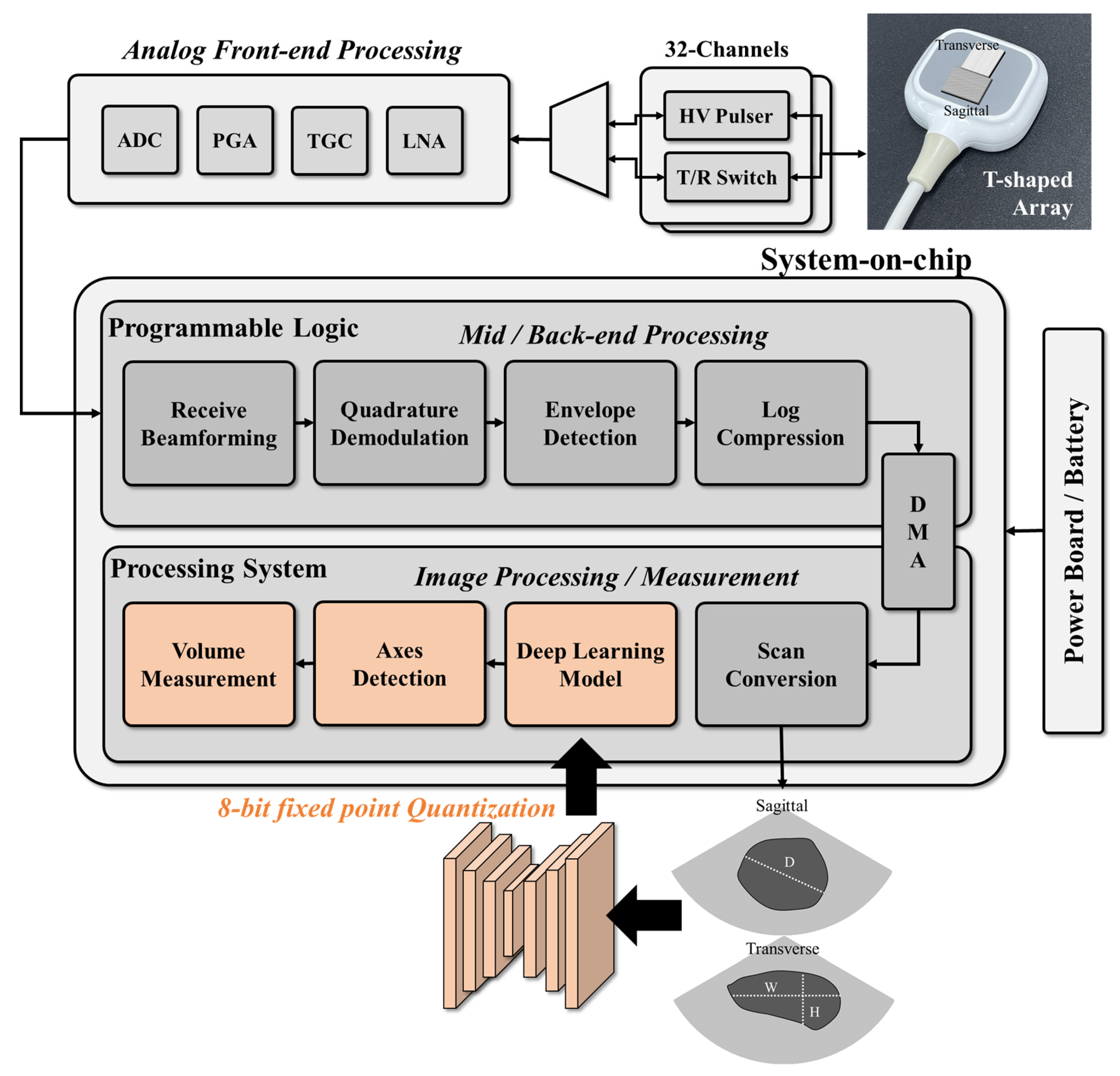 Bioengineering | Free Full-Text | A Lightweight Deep Learning Network on a  System-on-Chip for Wearable Ultrasound Bladder Volume Measurement Systems:  Preliminary Study
