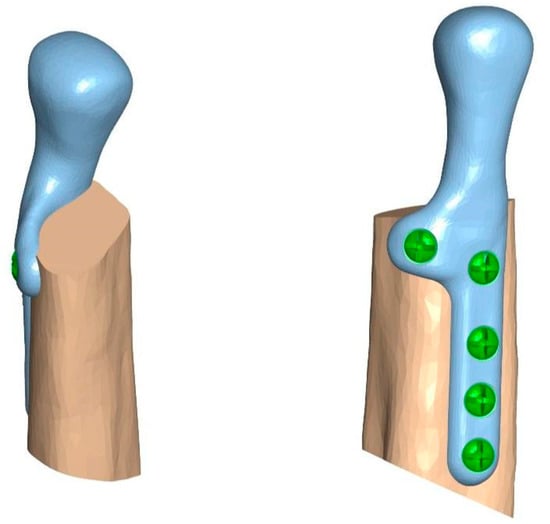 https://www.mdpi.com/bioengineering/bioengineering-10-00541/article_deploy/html/images/bioengineering-10-00541-g002-550.jpg