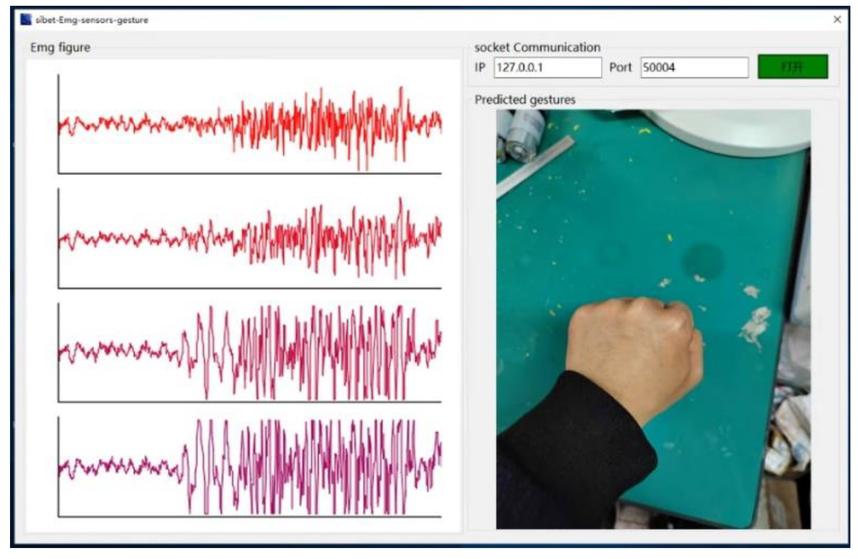 Bioengineering 10 00557 g016 Bioengineering 10 00557 g016