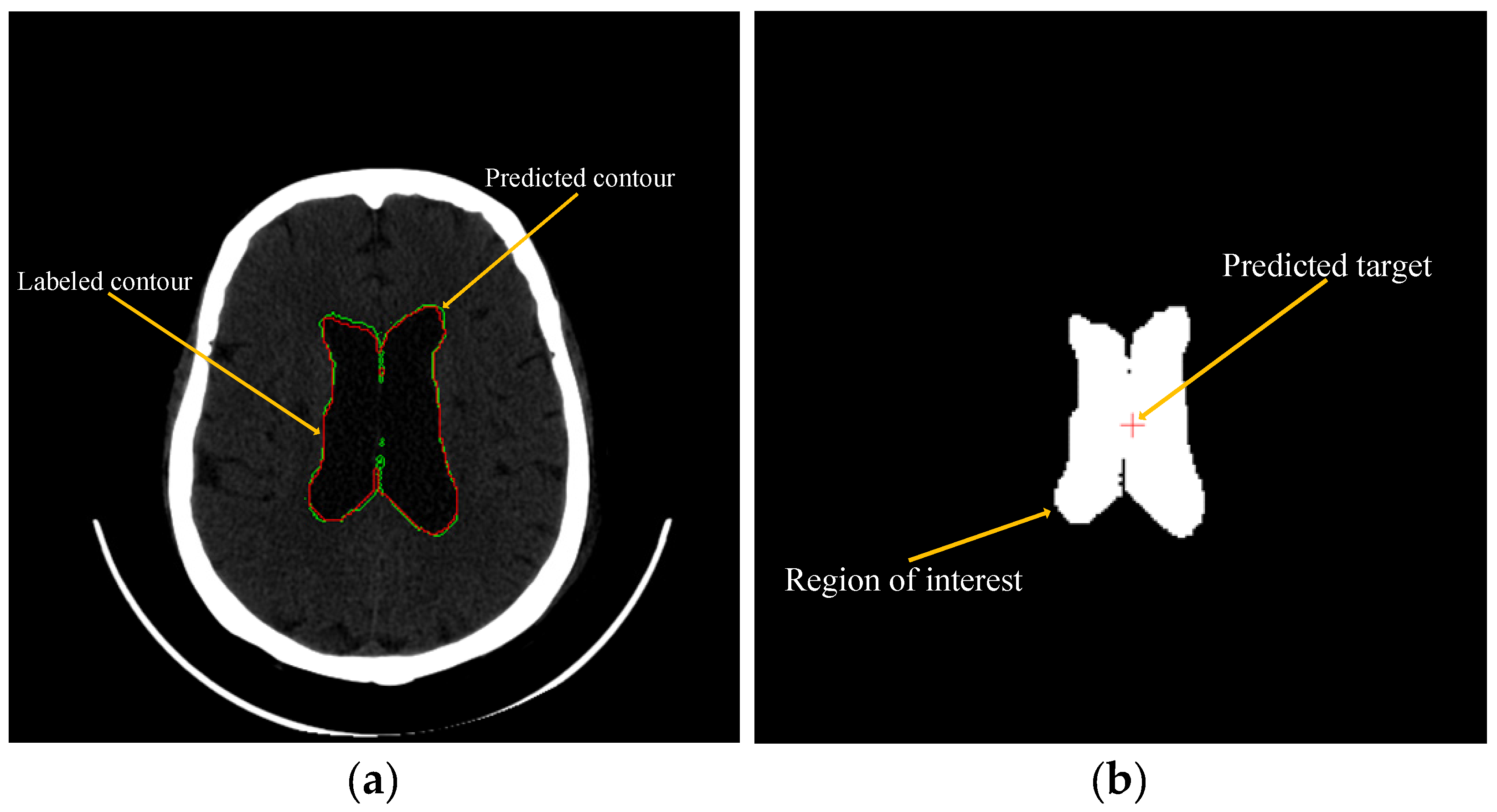 Bioengineering 10 00617 g004 Bioengineering 10 00617 g004