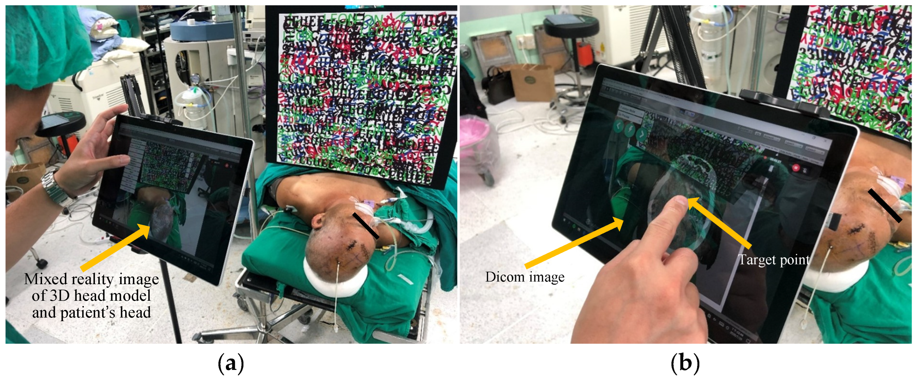 Bioengineering 10 00617 g005a Bioengineering 10 00617 g005a