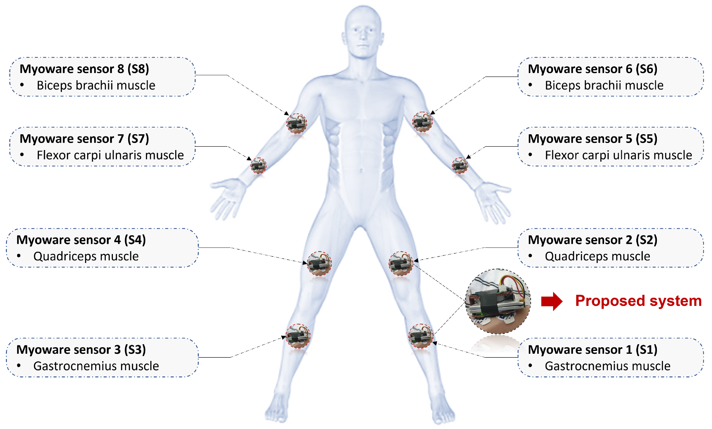 Bioengineering | Free Full-Text | Wearable Electromyography ...