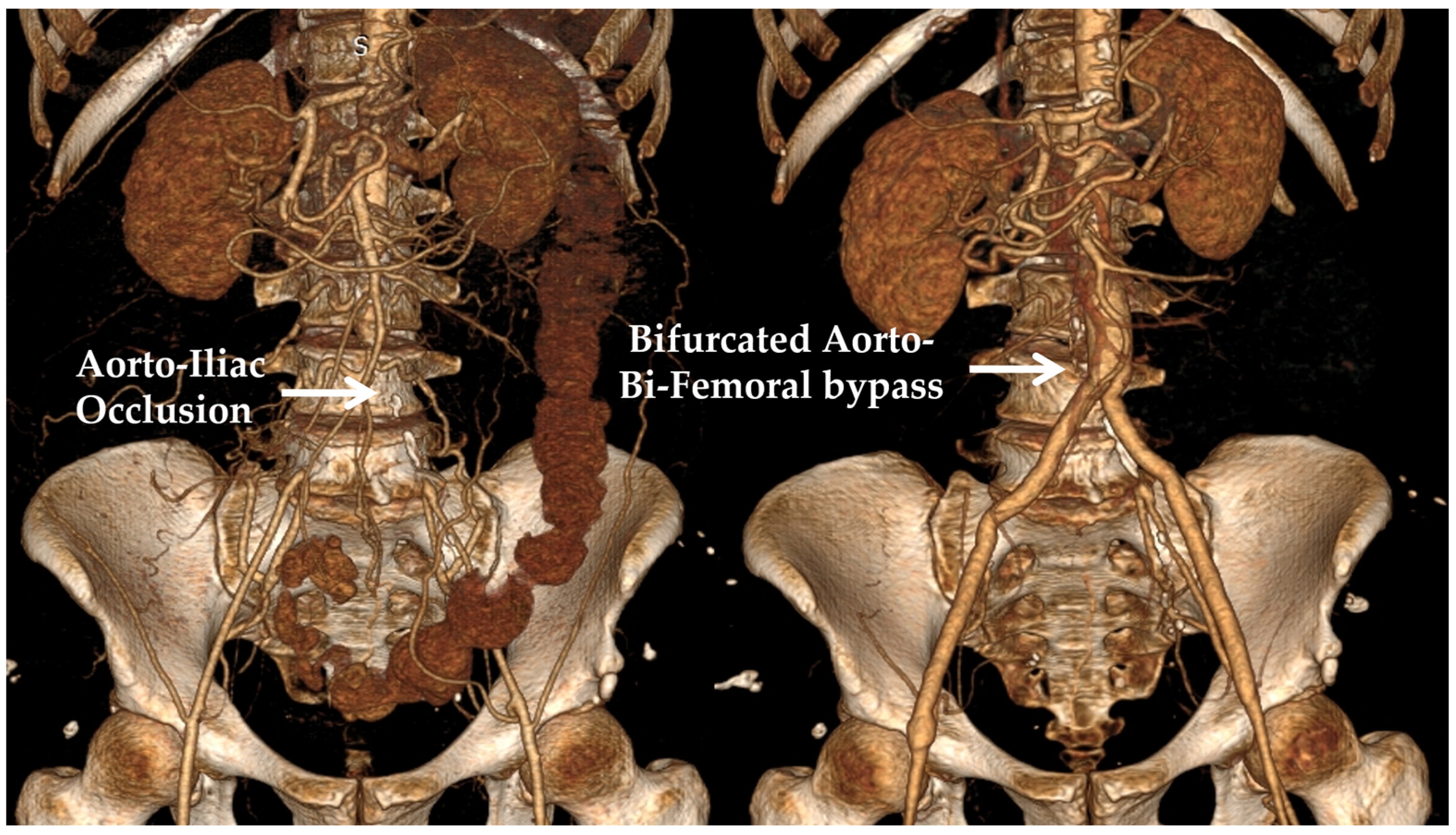 Bioengineering 10 00776 g001 Bioengineering 10 00776 g001