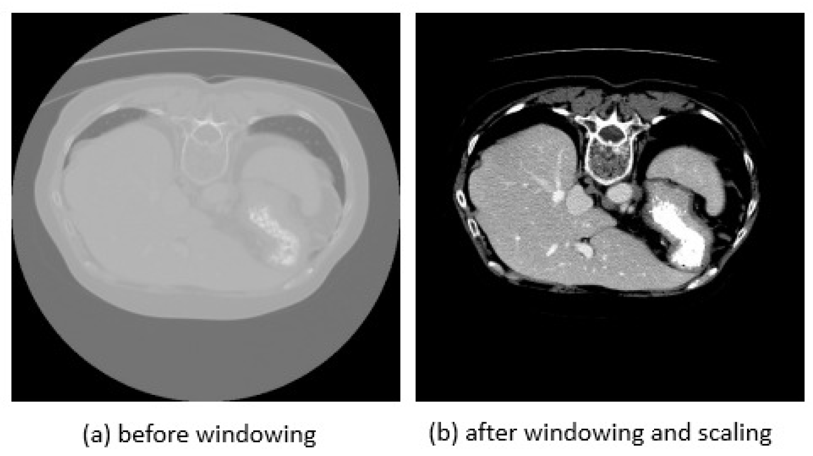 Bioengineering 10 00899 g003 Bioengineering 10 00899 g003