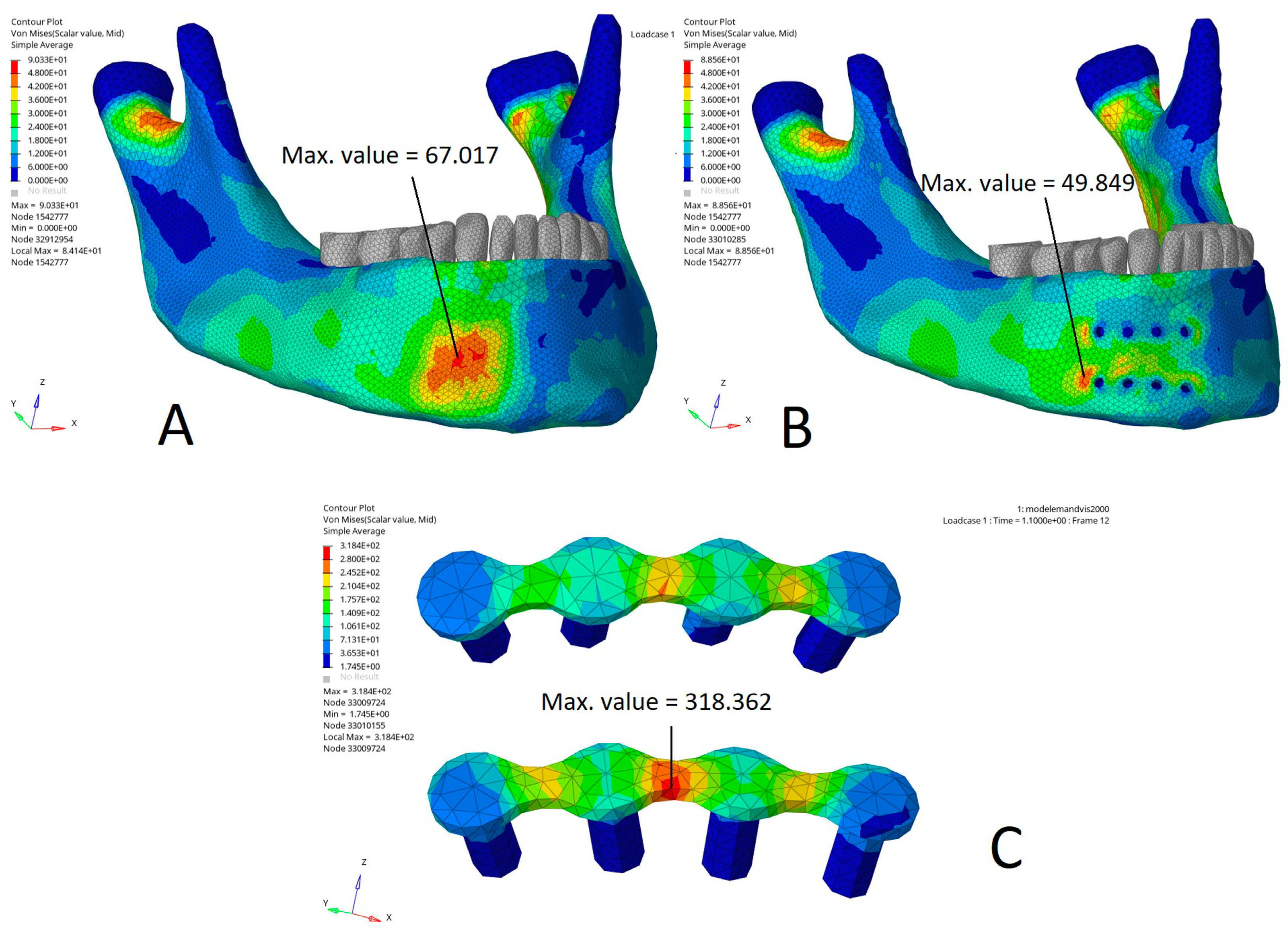 Bioengineering 10 00994 g004