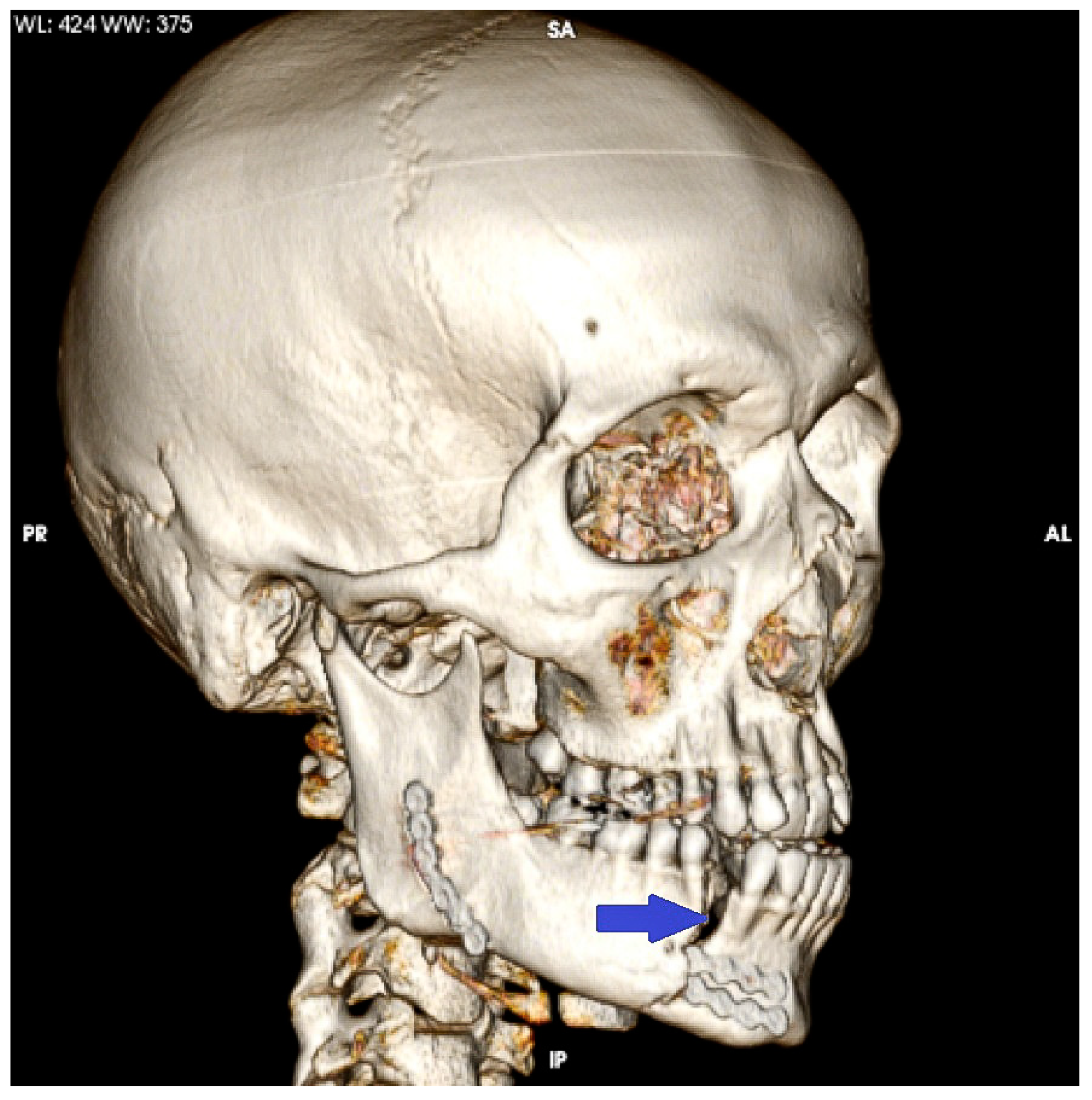 Bioengineering 10 00994 g009