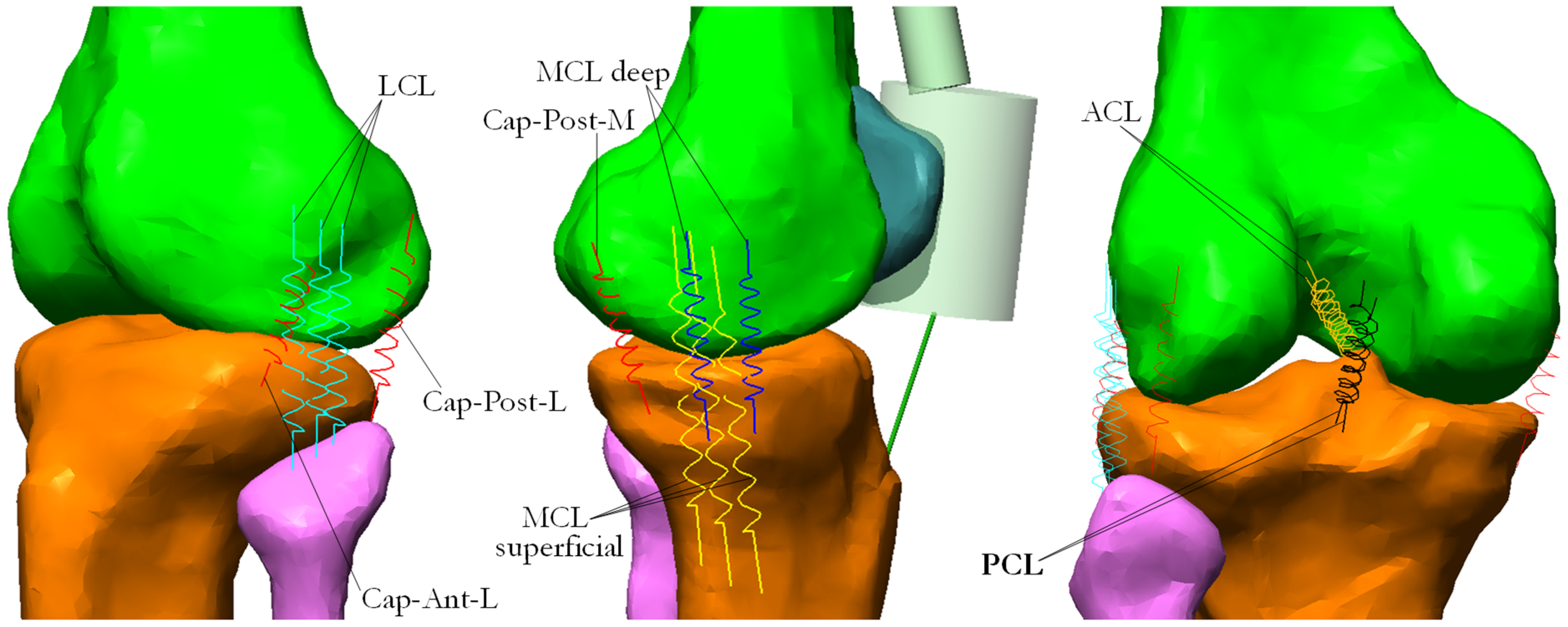 Understand Knee Ligament Injuries (ACL, PCL, MCL, LCL) - 3D animation 