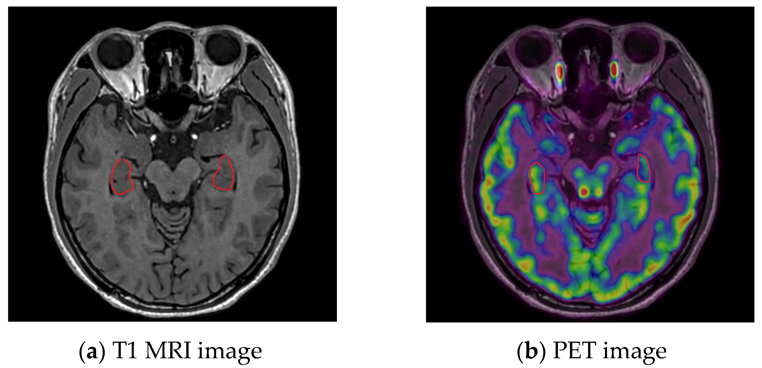 Bioengineering 10 01234 g005