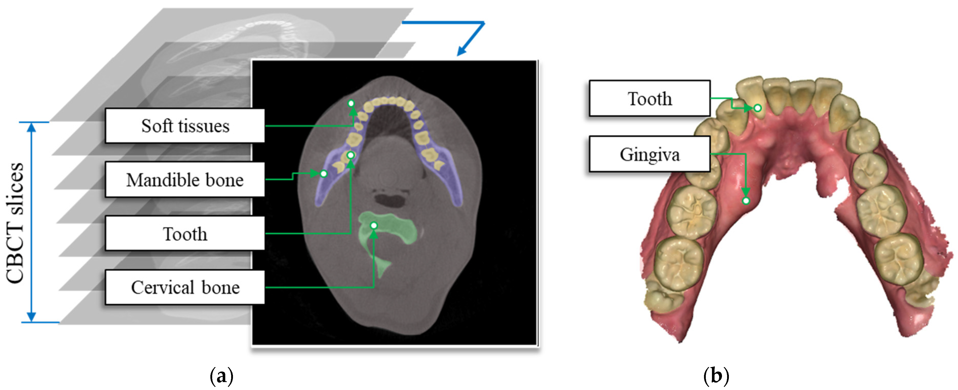 1,341 Root Canal 3d Images, Stock Photos, 3D objects, & Vectors
