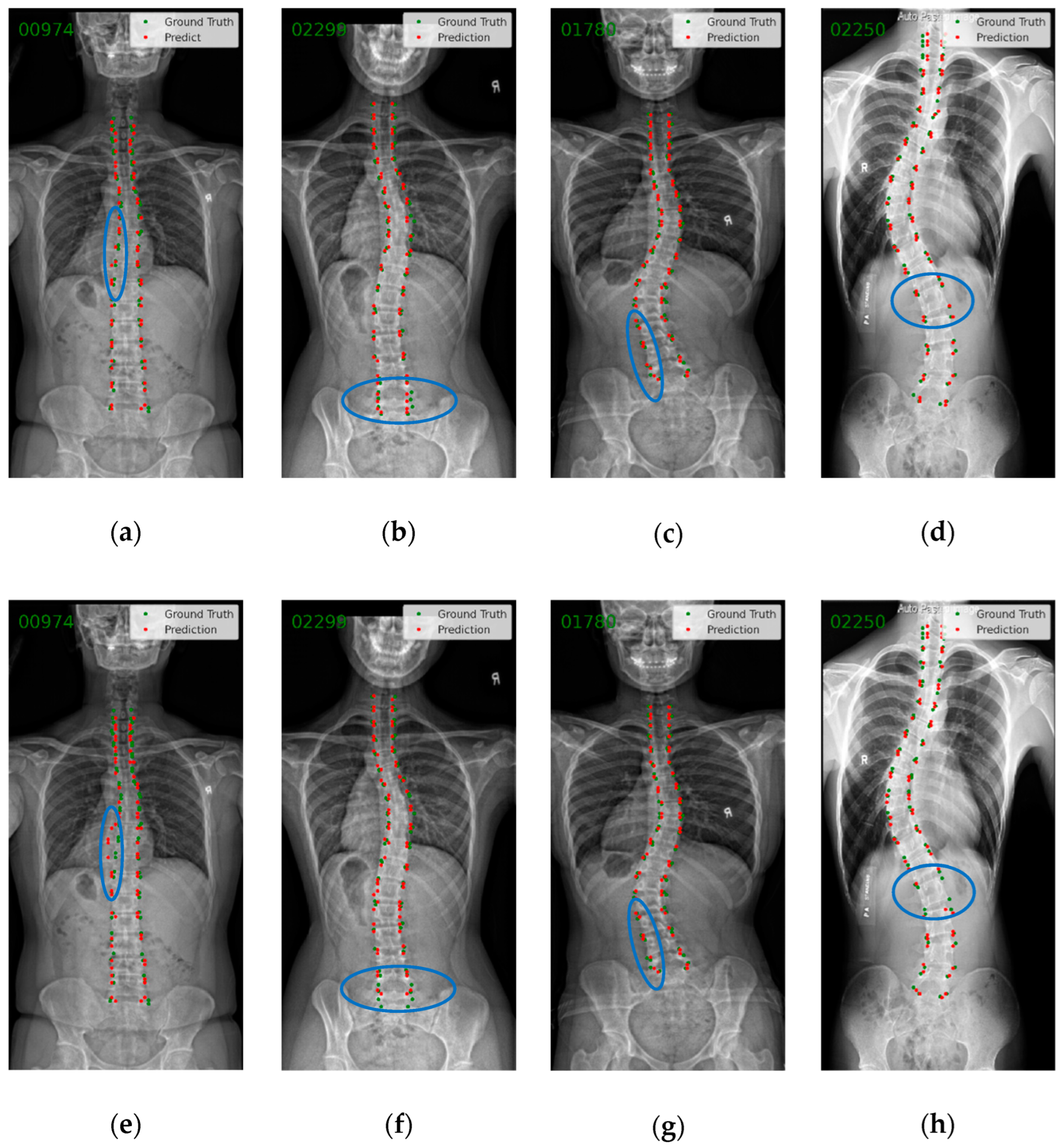 Bioengineering | Free Full-Text | SpineHRformer: A Transformer 