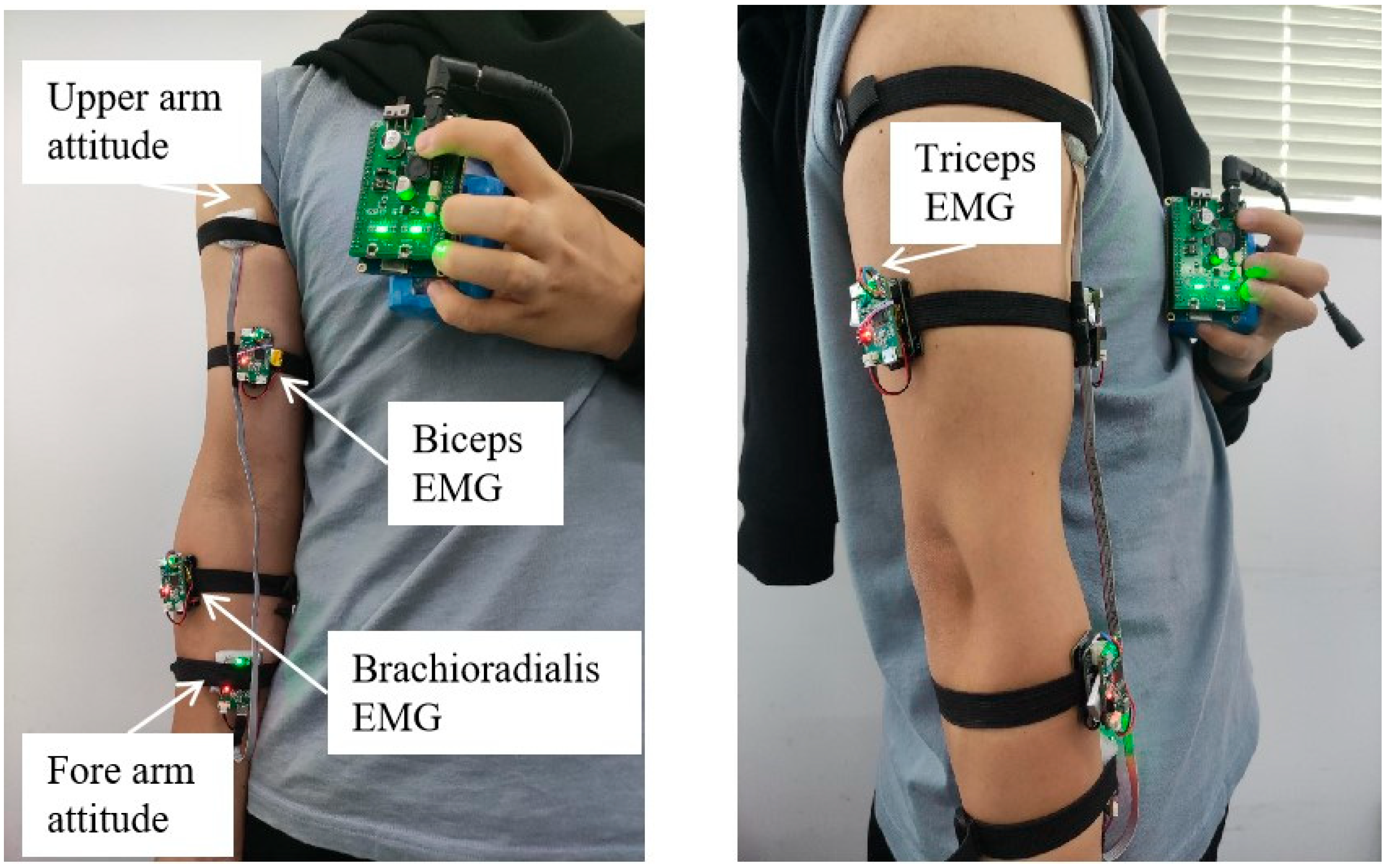 Bioengineering 10 01441 g003