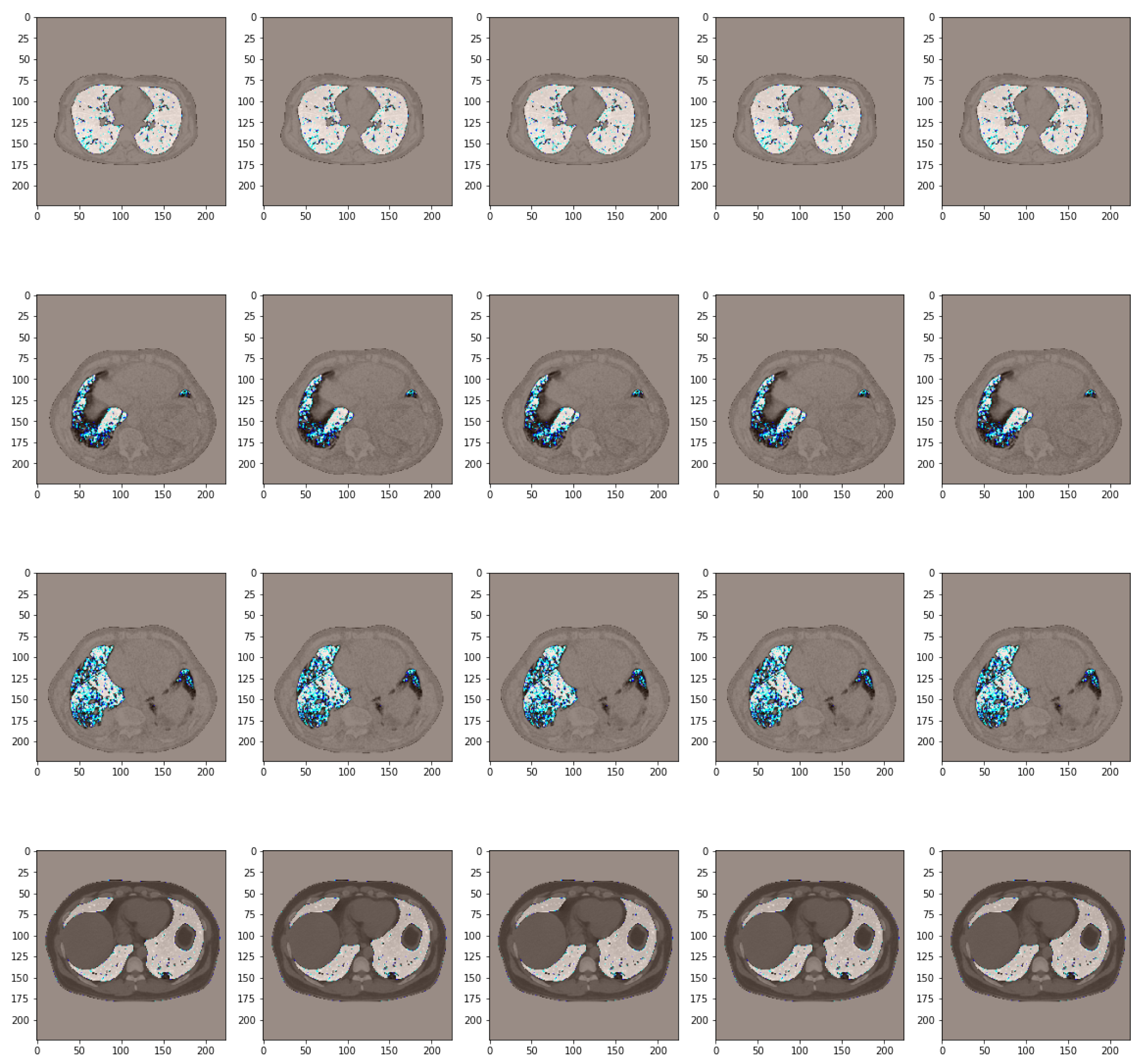 Bioengineering 11 00079 g011
