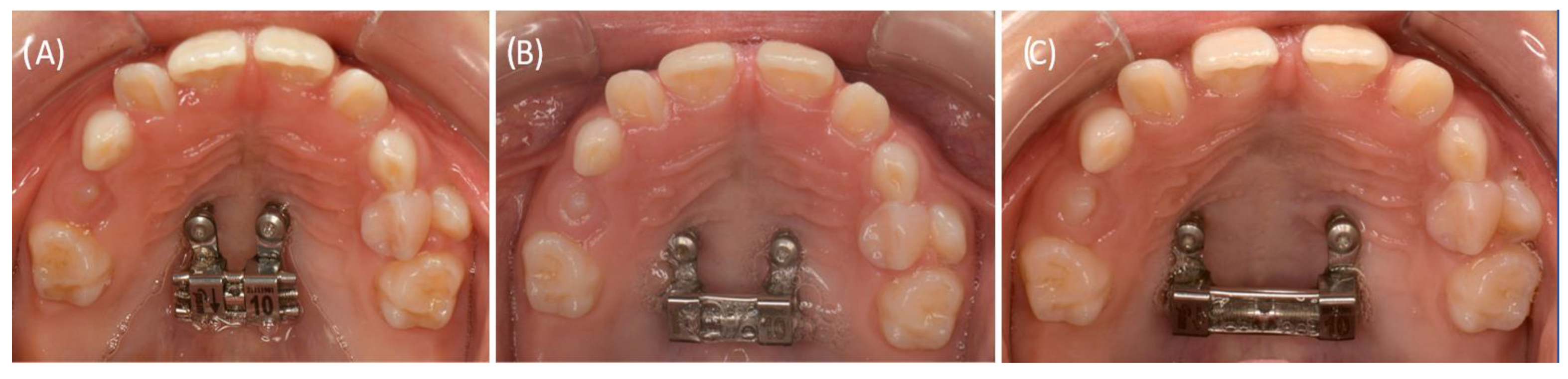 Bioengineering 11 00091 g005 Bioengineering 11 00091 g005