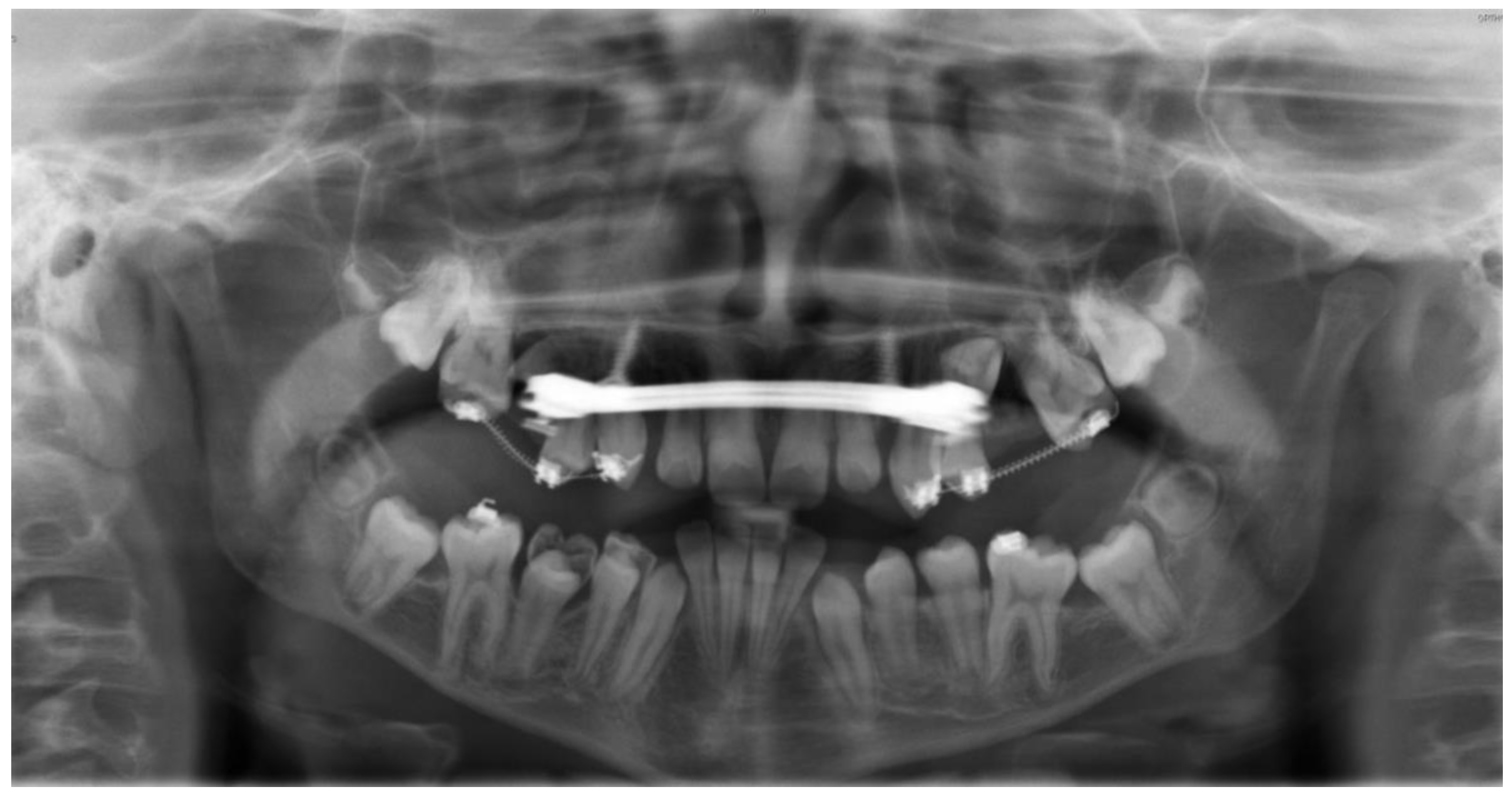Bioengineering 11 00091 g007 Bioengineering 11 00091 g007