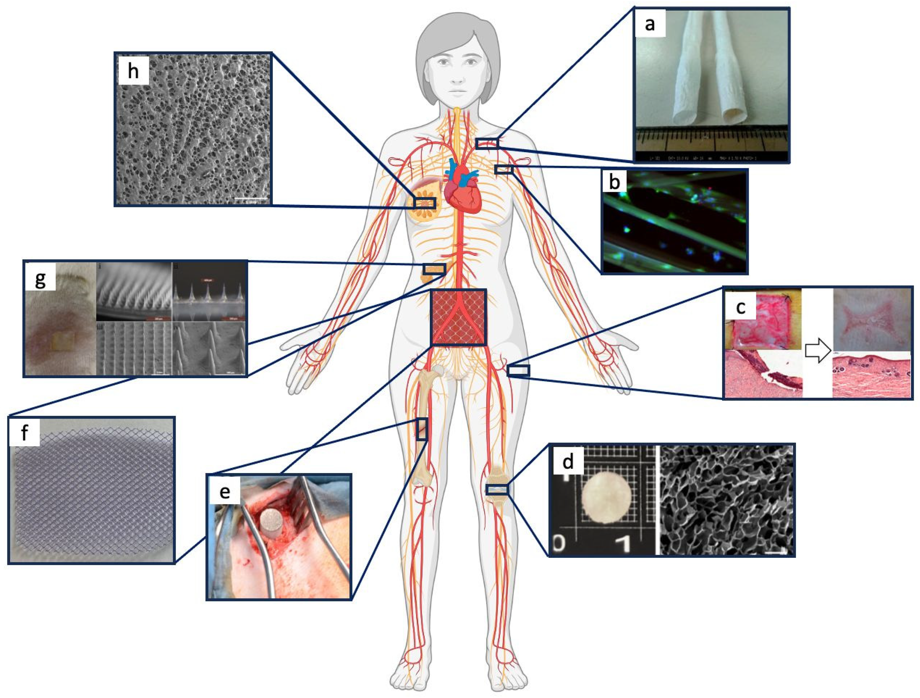 Bioengineering 11 00167 g004