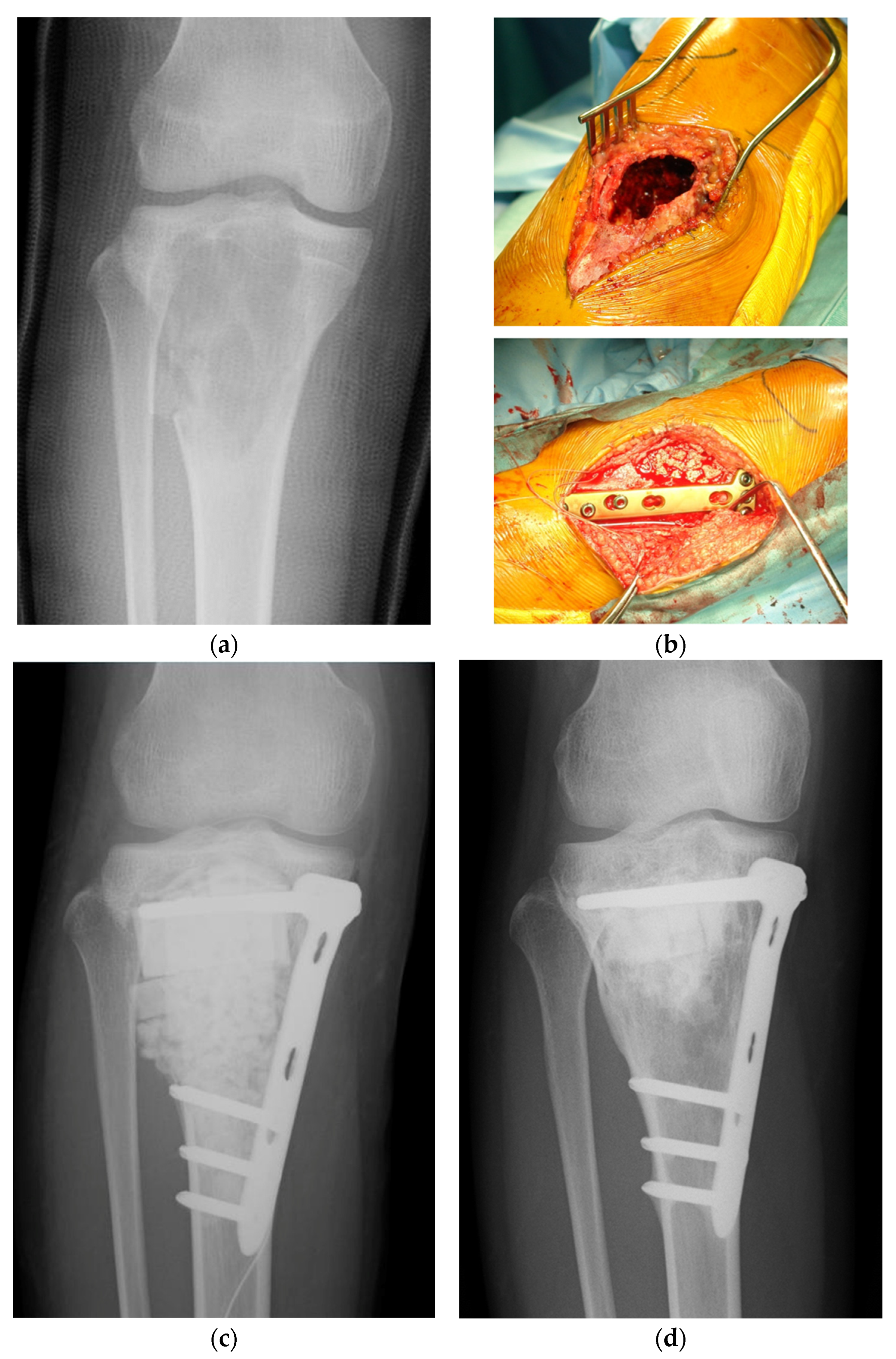 Bioengineering 11 00180 g002 Bioengineering 11 00180 g002