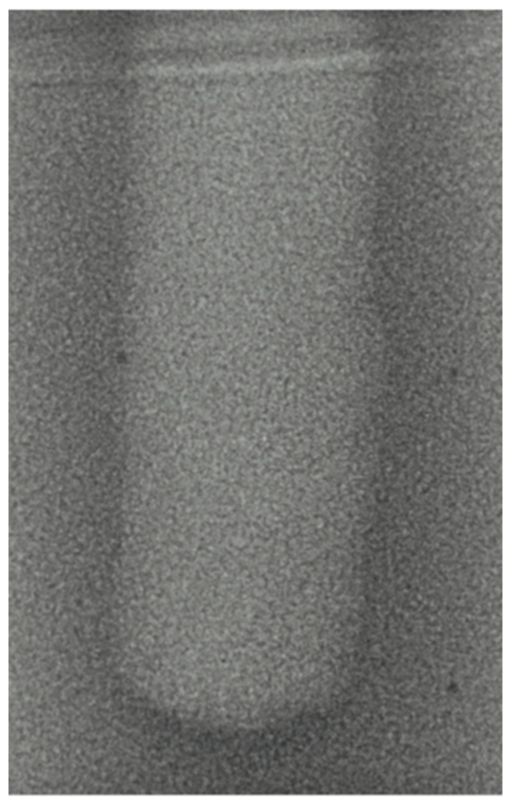 Bioengineering 11 00383 g004