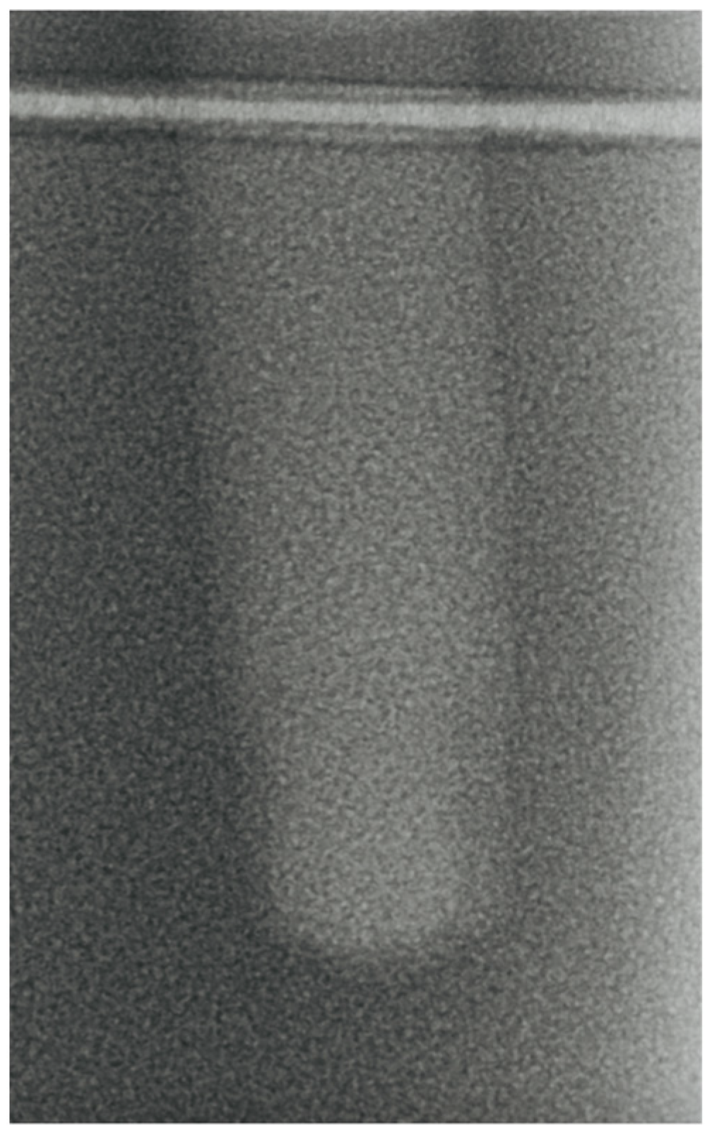 Bioengineering 11 00383 g005